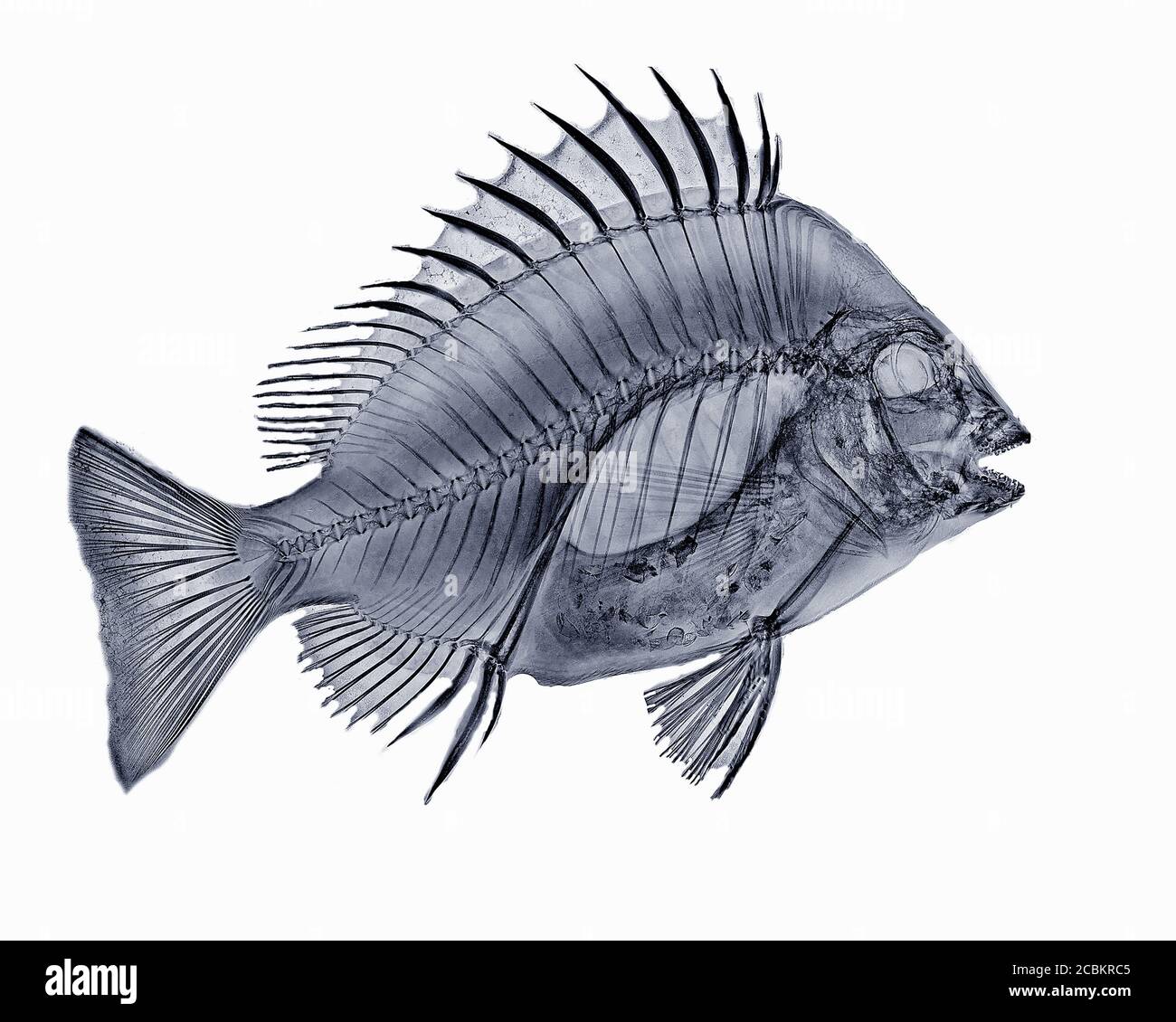 Image à rayons X du poisson à tête de mouton Banque D'Images
