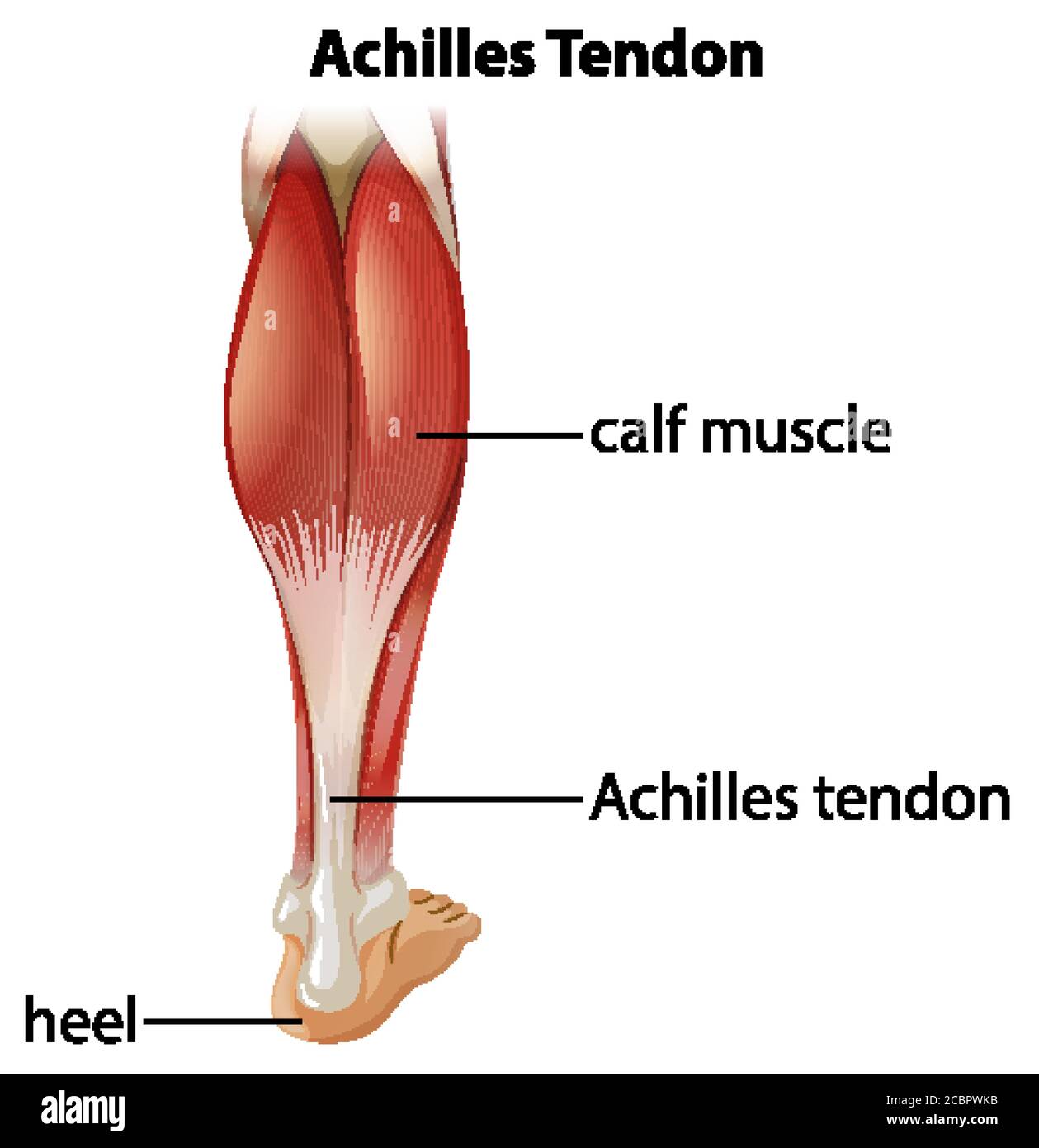 Infographie médicale de l'illustration du tendon d'achille Illustration de Vecteur