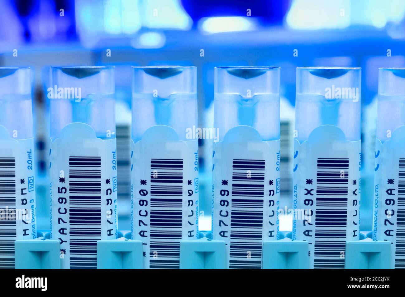Analyse des échantillons fécaux pour la présence de sang occulte (caché) dans le dépistage du cancer de l'intestin à grande échelle Banque D'Images