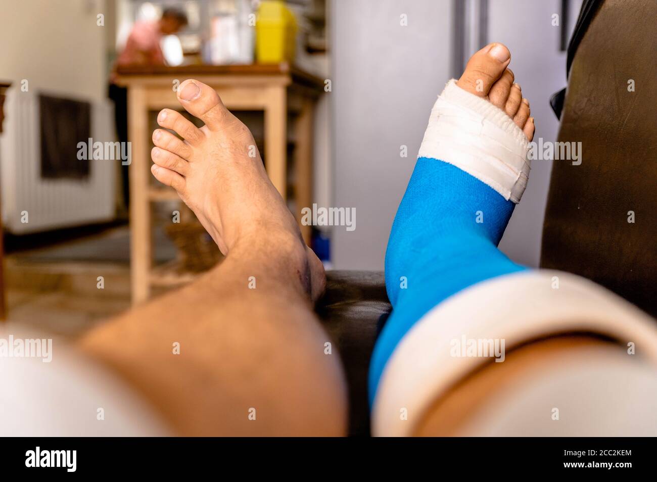 Un homme se repose sur une chaise levée après une opération de chirurgie du pied Banque D'Images