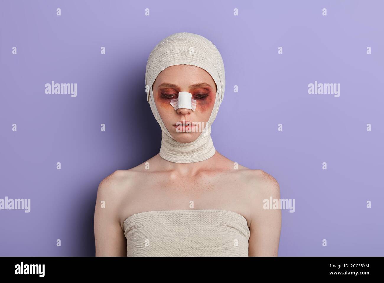 Nez Casse Banque D Image Et Photos Alamy