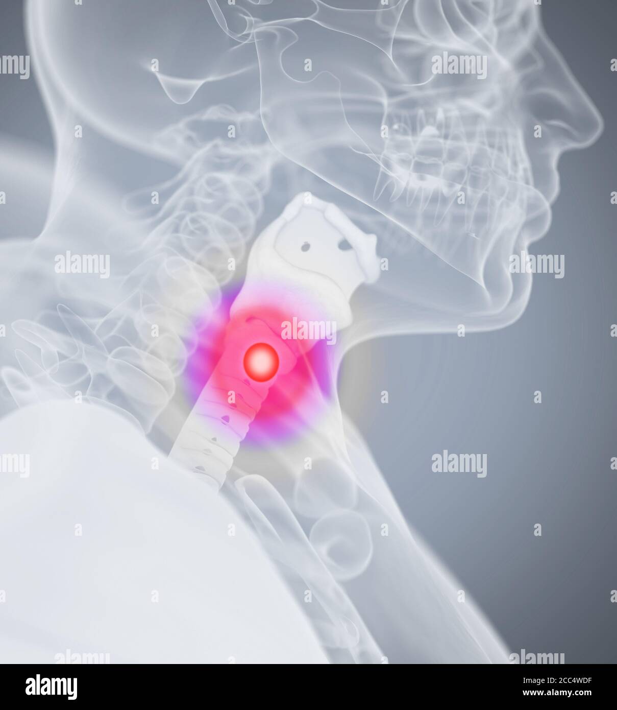Douleur dentaire. Image xray de la tête de l'anatomie humaine. Illustration 3D. Banque D'Images