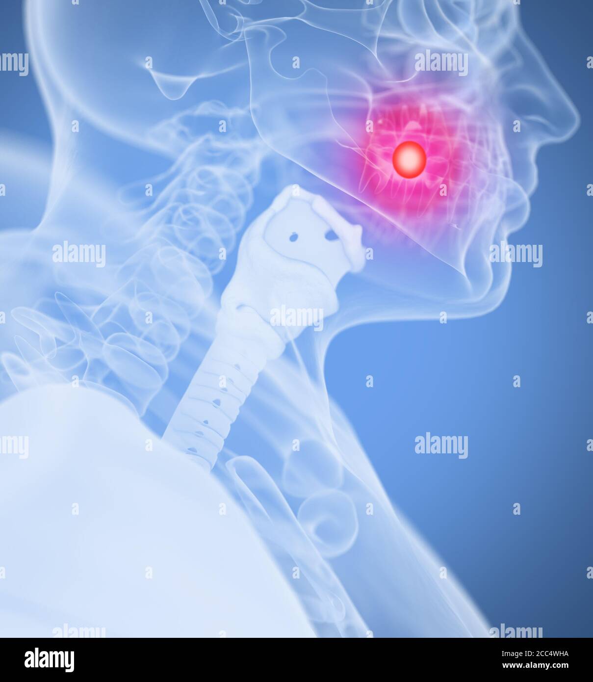 Douleur dentaire. Image xray de la tête de l'anatomie humaine. Illustration 3D. Banque D'Images