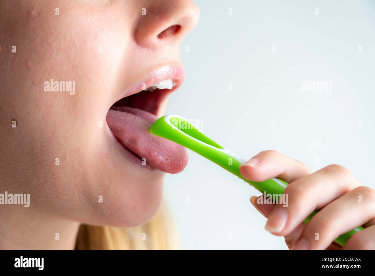 Mauvaise haleine, prévention en nettoyant la langue à l'aide d'une brosse pour langue Banque D'Images