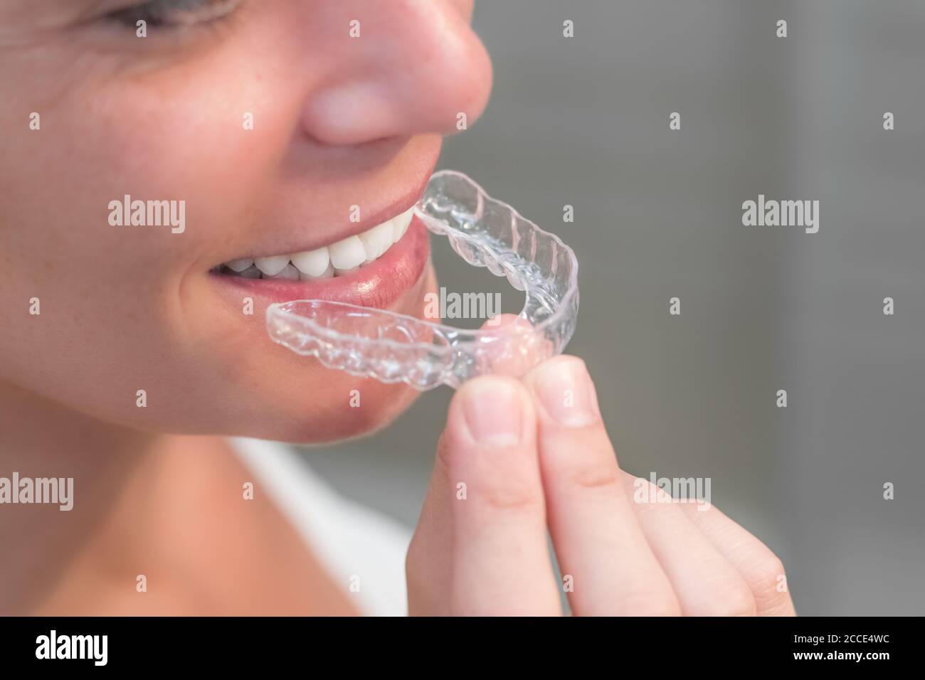 Appareil dentaire adulte Banque de photographies et d'images à haute  résolution - Alamy