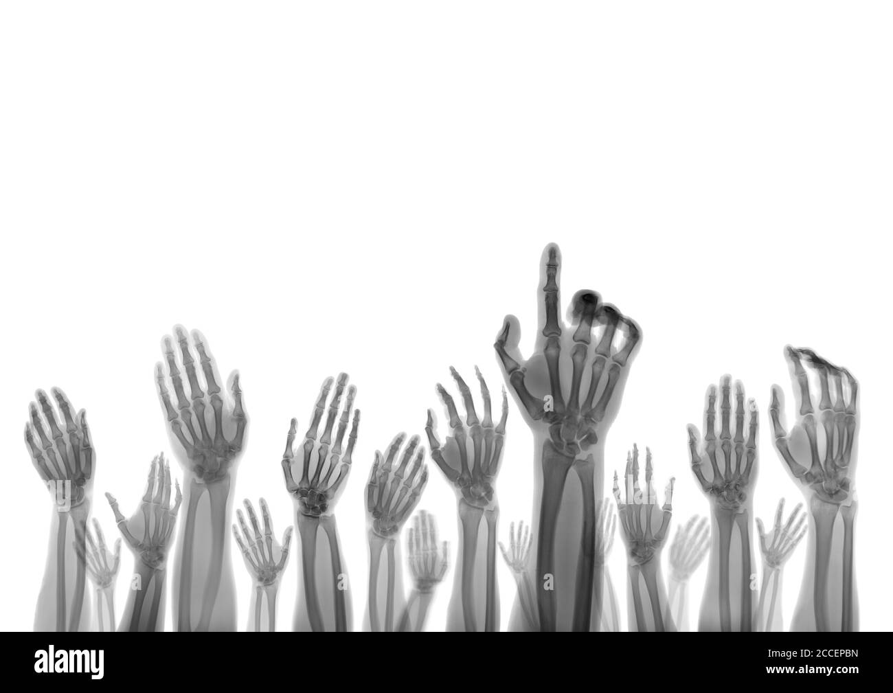 Mains, rayons x Banque D'Images