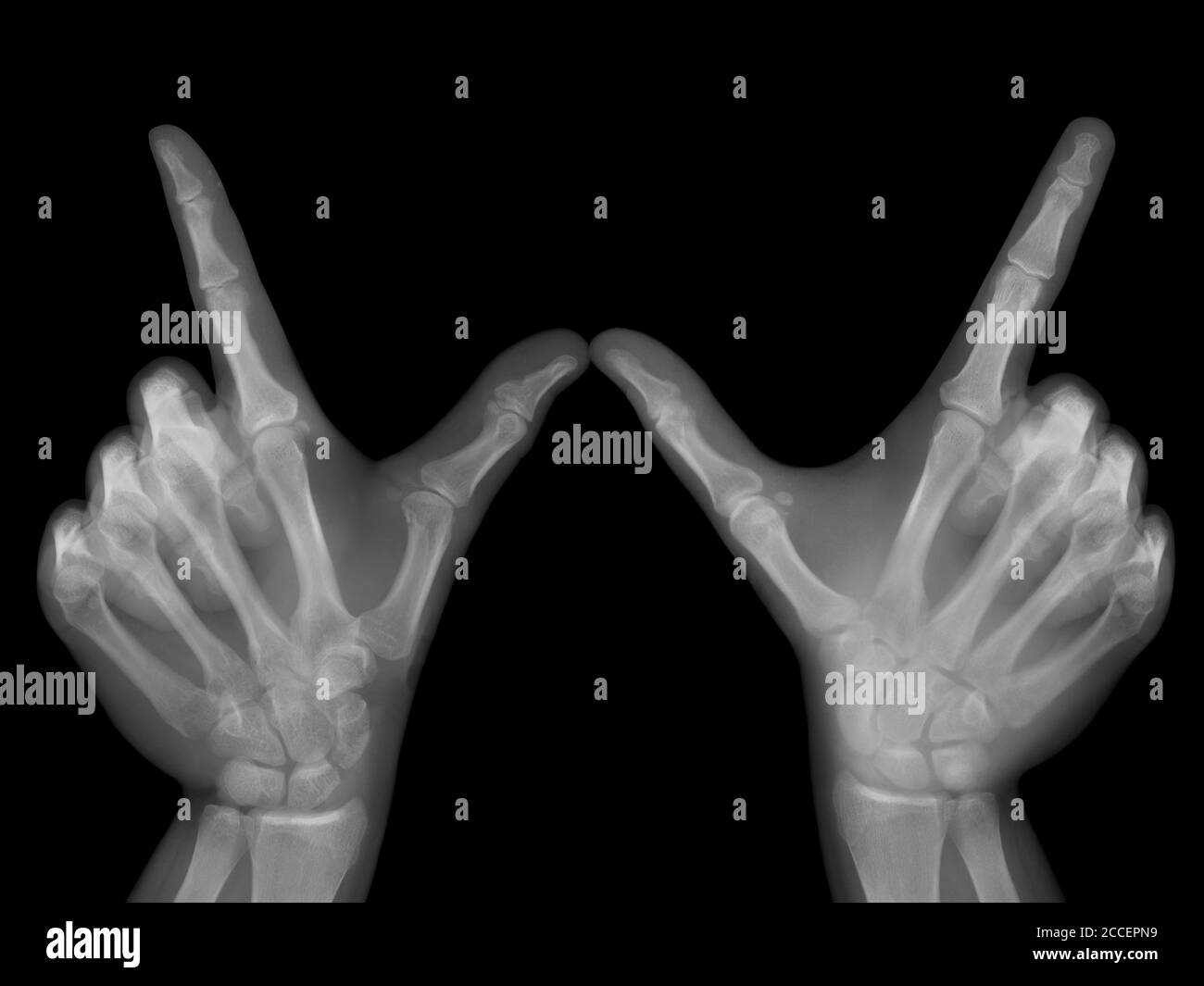 Quels que soient les gestes des mains, les rayons X. Banque D'Images