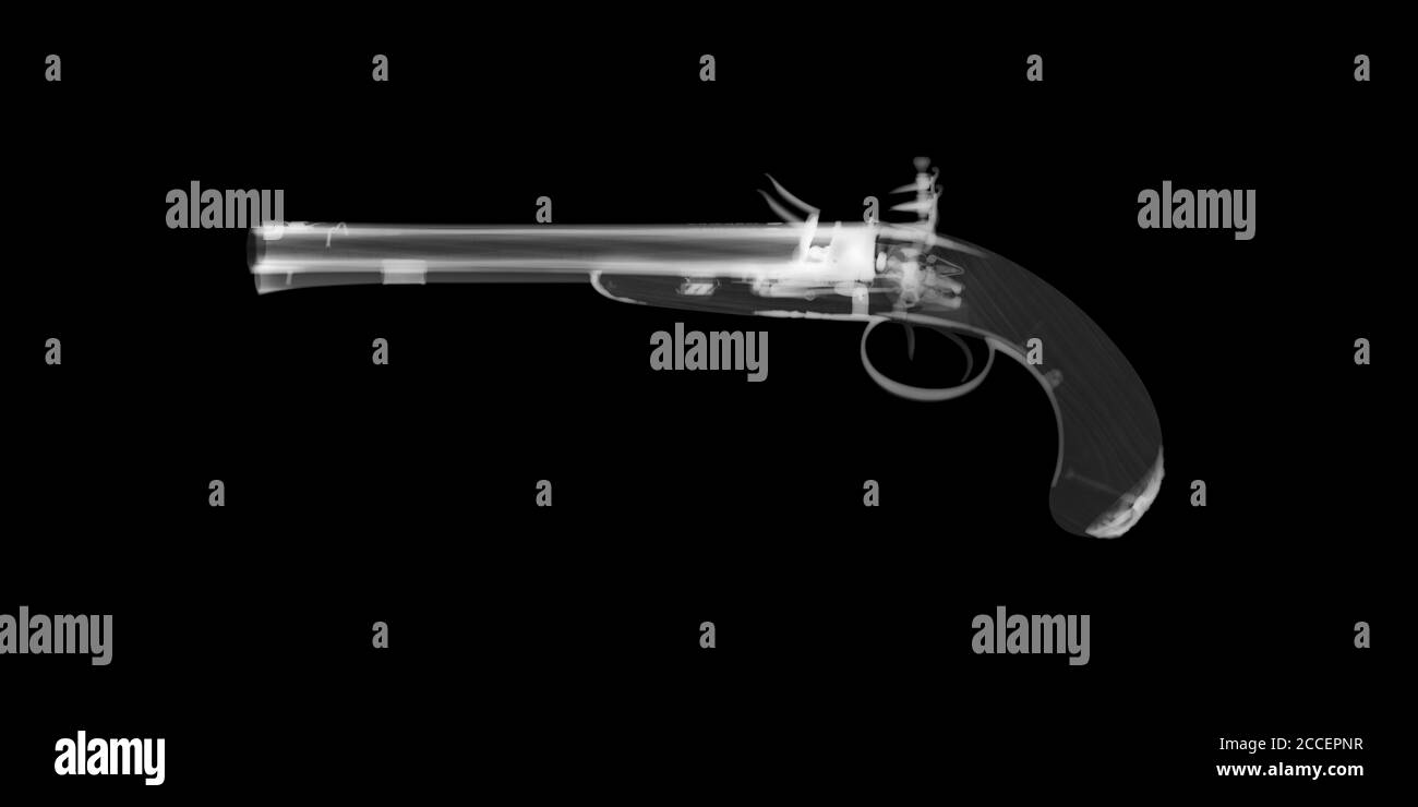 Pistolet à serrure à fil Wogdon, rayons X. Banque D'Images