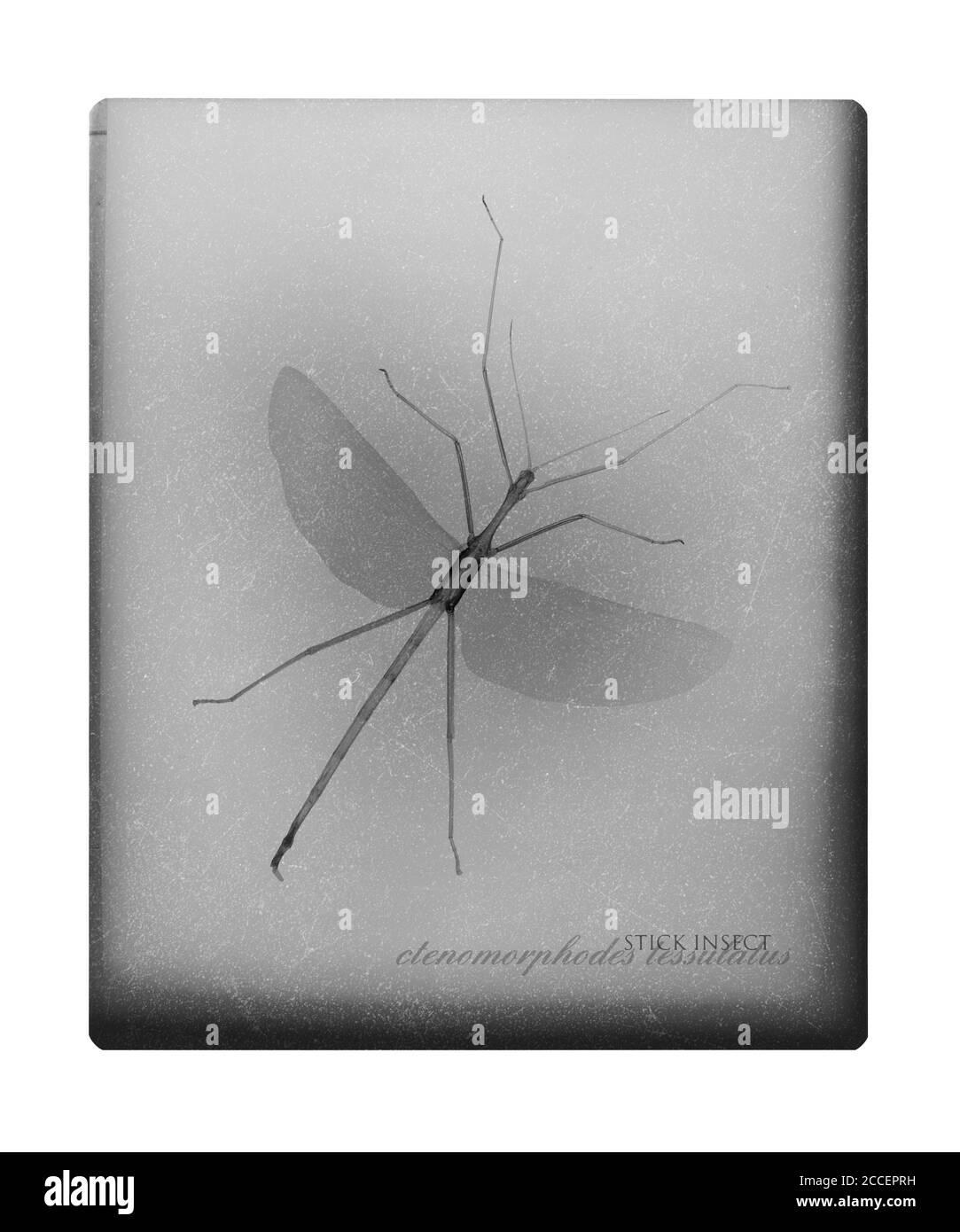 Insecte bâton, rayons X. Banque D'Images