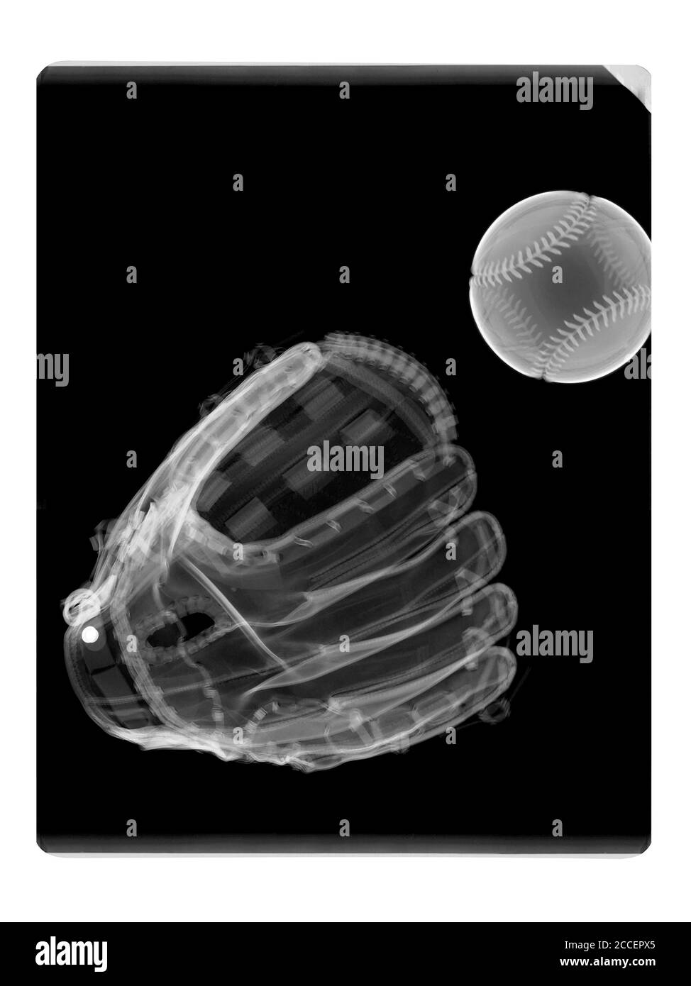 Baseball et gant, rayons X. Banque D'Images