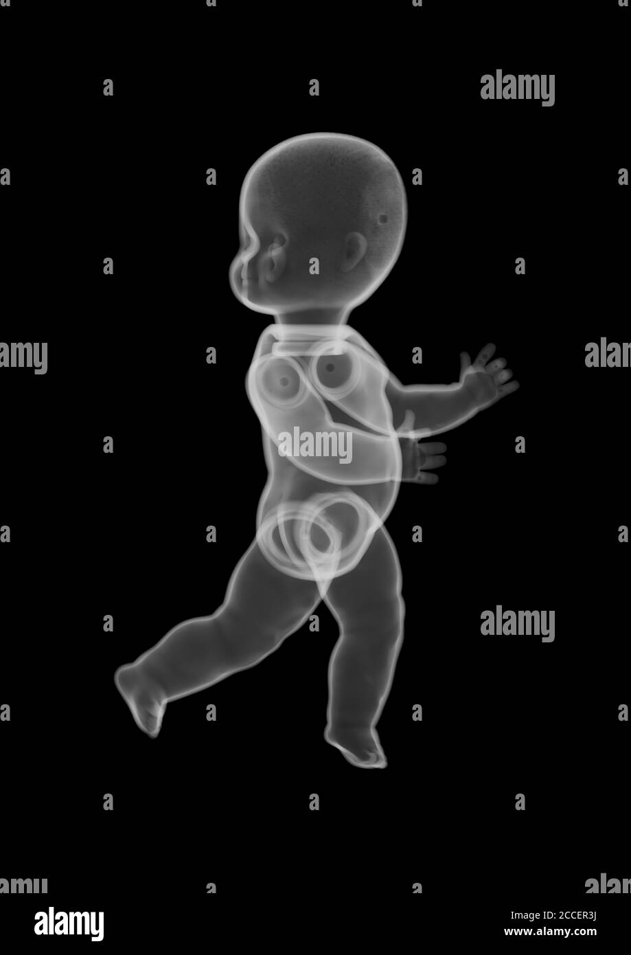 Jouet de poupée en plastique pour bébé, rayons X. Banque D'Images