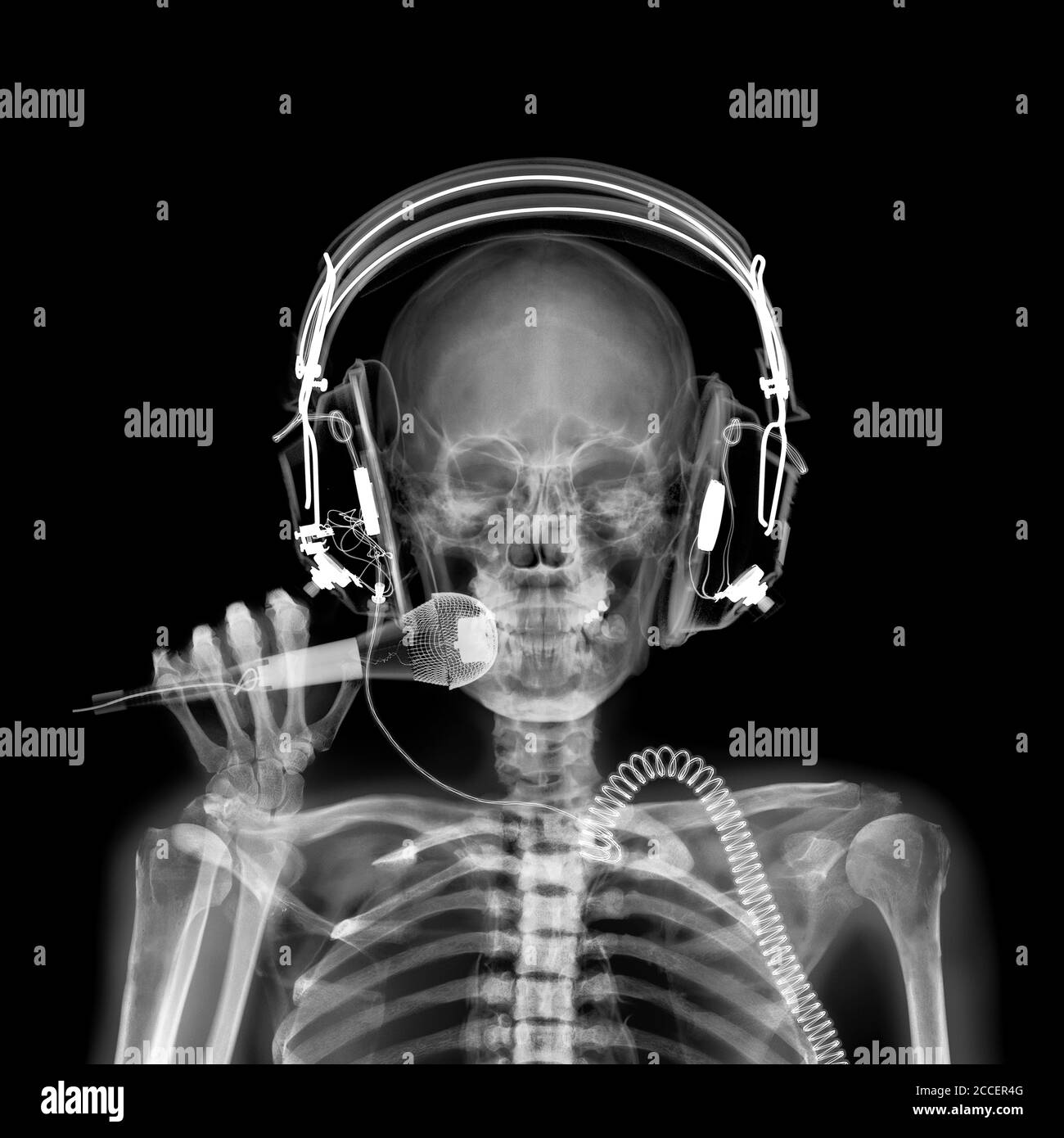 Disque jockey, rayons X. Banque D'Images