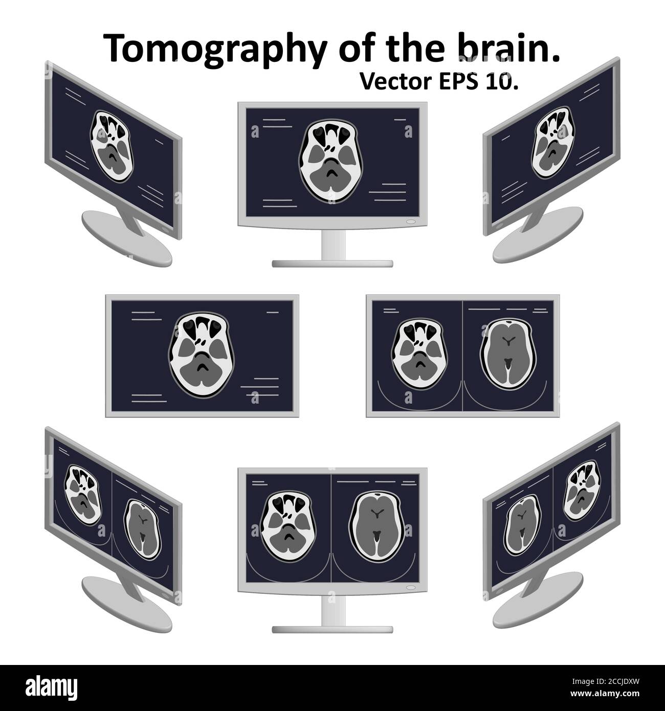 Ensemble de coupe transversale du cerveau pendant l'imagerie par résonance magnétique sur un écran d'ordinateur en vue isométrique. Quelques images de l'image du cerveau. Illustration de Vecteur