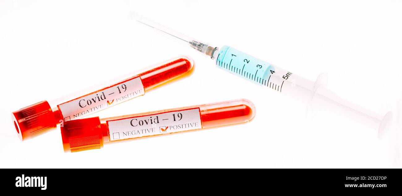 Le vaccin contre le coronavirus. Tests sanguins positifs pour le coronavirus dans les tubes à essai. Banque D'Images