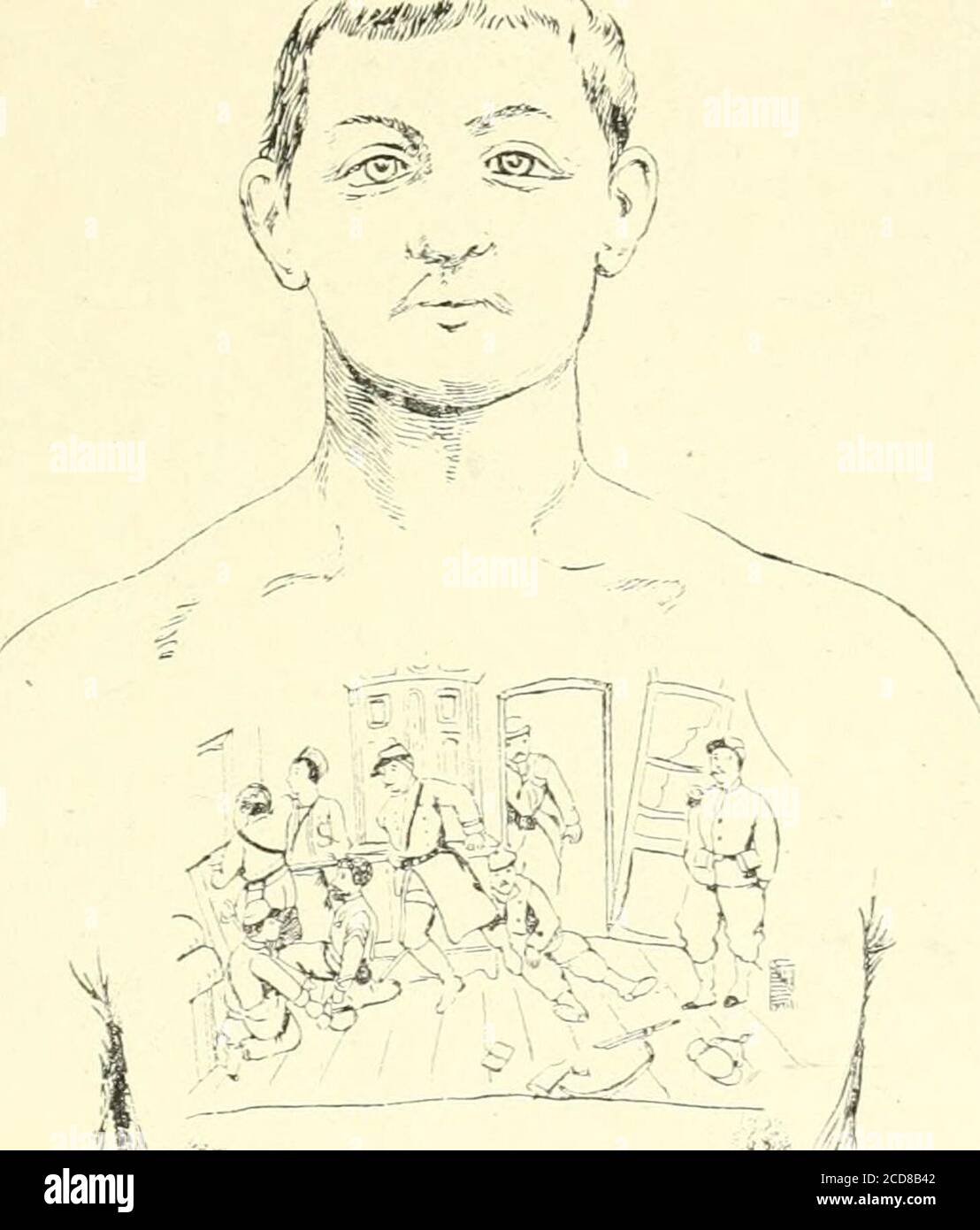 . Les seins dans l'histoire . une photographie dun joi/ciix singuliè-rement tatoué sur le thorax (fig. 2Ti . Entre les deux mamelles estdessiné, au pointillé, une femme couverte nue sur un canapé, dansla pose alanguie de la Danaé du Titien, les jambes écarted, unbras, Tautre rejoué sur la poiterne, elle semble de sortir. A ses pieds, un homme nu, vu de dos, arrière enHercule, probablement le « petit homme )&gt; de son rêve, fait desposes plastiques. Au bas du canapé se lit linscription : voile deVc)ius. Ce « petit homme » nous nous parait être tout simple (l) Édition, F&gt;. Banque D'Images