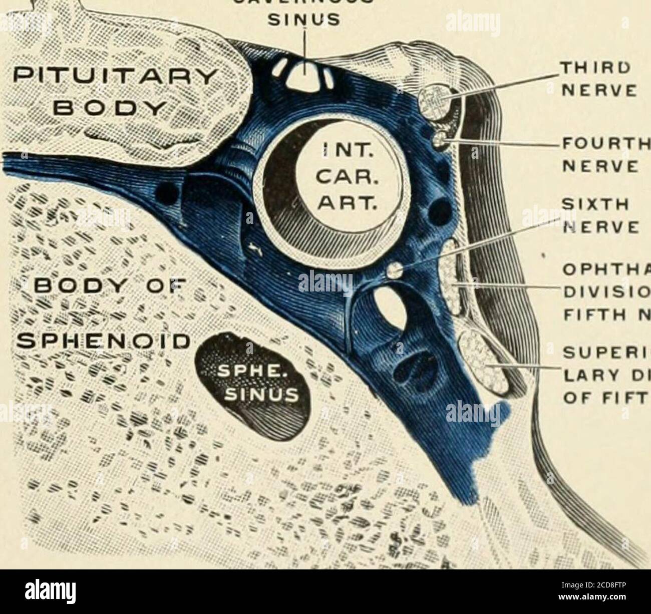 . Un traité sur les maladies de l'oeil . Veines de l'orbite. (Poirier et Charpy.) FIGURE 2 TRAVERNOUSSINUS TRAVERSESINUS. ..;j.--i-»^^<t THIRONERVE OPHTHALMICDIVISION OFFIFTH NERVE SUPERIOR MAXIL-LARY DIVISIONAF FL FTH NERVE Section frontale à travers le sinus caverneux droit. (Spalteholz.) NERFS OCULAIRES. 41 en entrant dans l'orbite, il passe au-dessus du nerf optique et entre dans le muscle supérieur oblique par le haut. Sixième nerf (Abducens).—le noyau de ce nerf est situé dans le tissu du plancher du quatrième ventricule, près de la ligne médiane, sous le genou des fibres du septième nerf- Banque D'Images . Un traité sur les maladies de l'oeil . Veines de l'orbite. (Poirier et Charpy.) FIGURE 2 TRAVERNOUSSINUS TRAVERSESINUS. ..;j.--i-»^^<t THIRONERVE OPHTHALMICDIVISION OFFIFTH NERVE SUPERIOR MAXIL-LARY DIVISIONAF FL FTH NERVE Section frontale à travers le sinus caverneux droit. (Spalteholz.) NERFS OCULAIRES. 41 en entrant dans l'orbite, il passe au-dessus du nerf optique et entre dans le muscle supérieur oblique par le haut. Sixième nerf (Abducens).—le noyau de ce nerf est situé dans le tissu du plancher du quatrième ventricule, près de la ligne médiane, sous le genou des fibres du septième nerf- Banque D'Images