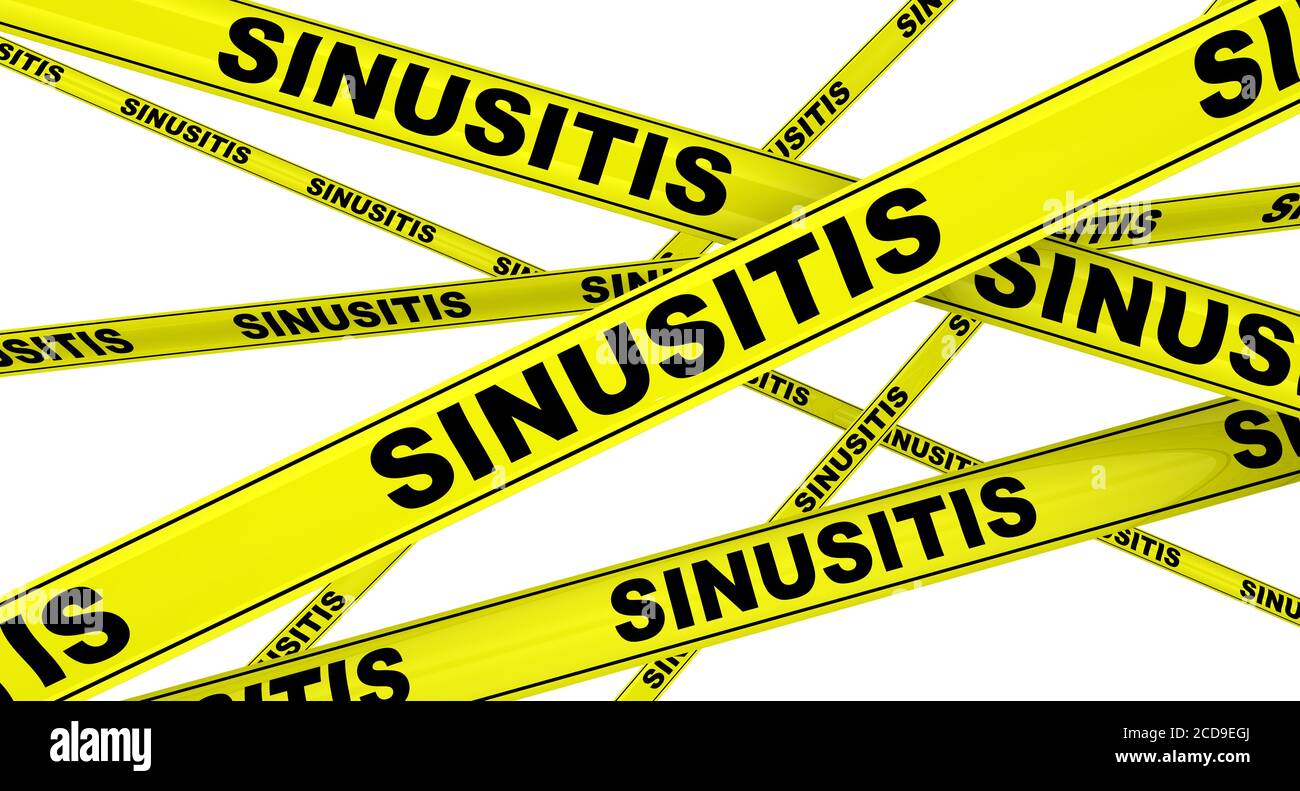 Sinusite. Rubans d'avertissement jaunes avec mots noirs SINUSITE (infection sinusale ou rhinosinusite). Isolé. Illustration 3D Banque D'Images