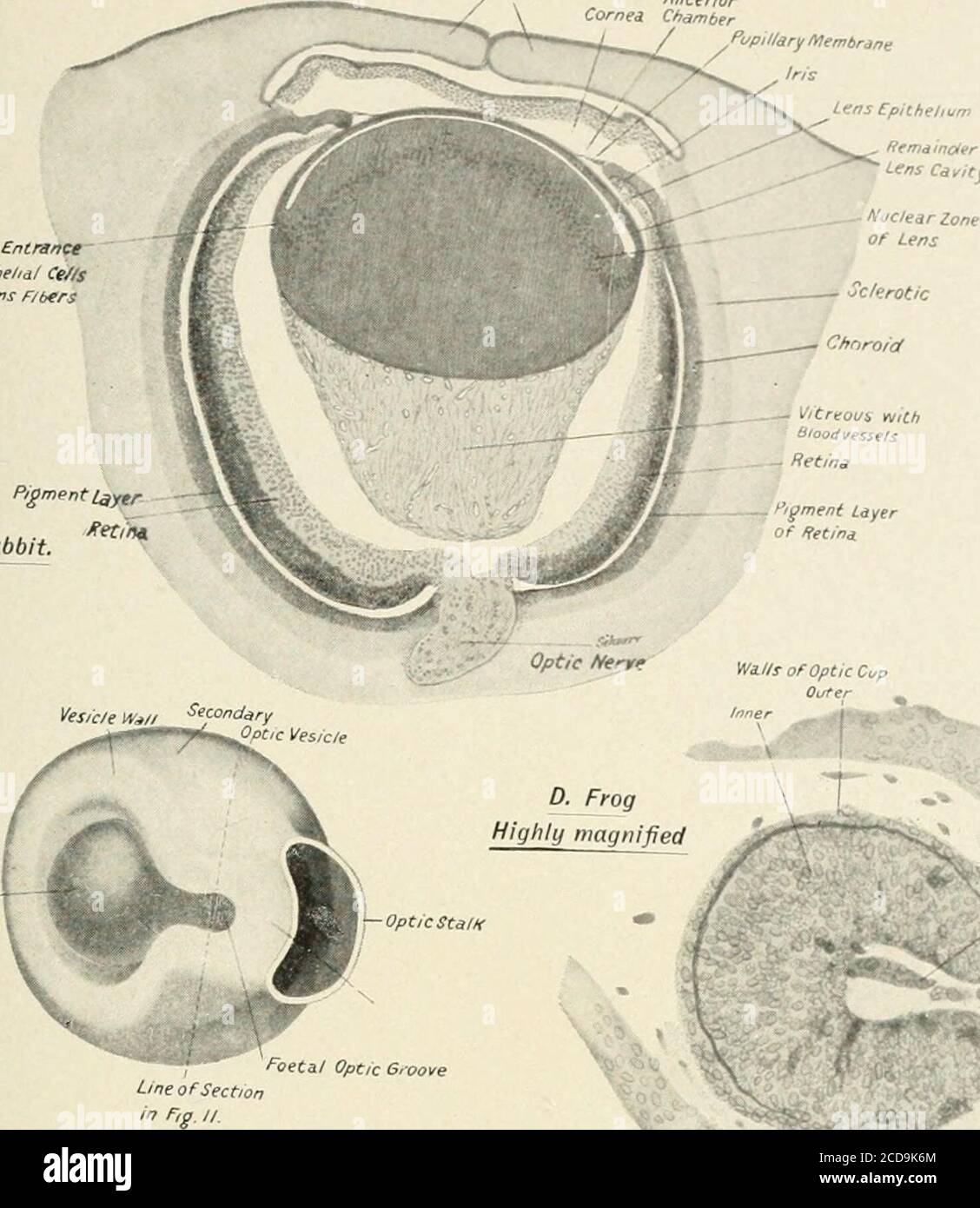. Un traité sur les maladies de l'oeil . Pigment Cpichhumof HeCin* E ...