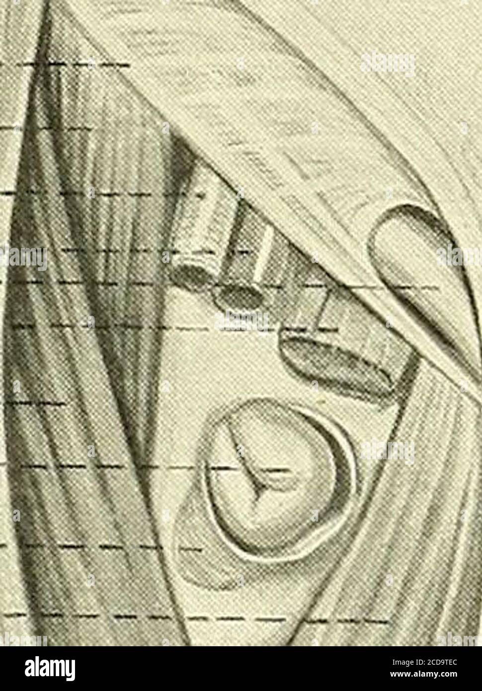 . Chirurgie, ses principes et sa pratique . Figure 66.UN bassin osseux dans lequel la membrane de l'obturateur (6) a été laissée dans le foramen de l'obturateur de theright. La membrane remplit entièrement le foramen, à l'exception d'une ouverture (a) qui est désignée comme le canal obturator. C'est par cette ouverture que la hernie obturatrice s'échappe, les obturatorvaisseaux et le nerf étant poussé d'un côté (Sultan). HERNIE OBTURATRICE. 97. Hernie fémorale et quelques cas de hernie inguinale, et récemment employé dans la hernie ob-turator par Schwartzschild. Schwartzschild a récemment utilisé thismethod dans un cas de hernie obturatrice, strugl Banque D'Images