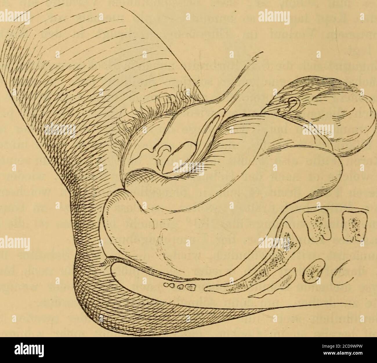 . Handbuch der Geburtshülfe . er auf der Unterlage, bo ist Beine Schwé demHervortren des Gesichtes über den Damm insfern einigermaßen hin-derlich, als die Oth fr endige lordotische Streckung du- Balrbel- säule schlecht underlich, als die an der Stankommen (Fig. 92). Was die Geburt der oberen Rumpfpartien betrifft, bo ist dieselbe 736 Otto Küstner.. Natürlich genau ebenso, ob es sieb um einfache oder doppelte Steisslage,UM Steissfusslage oder UM Fusslage handelt. OB BEI Fusslage die Kniee gestreckt oder gebeugt sind, ist fürden Mechanismus ebenfalls absout sans importance. §. 218. Banque D'Images