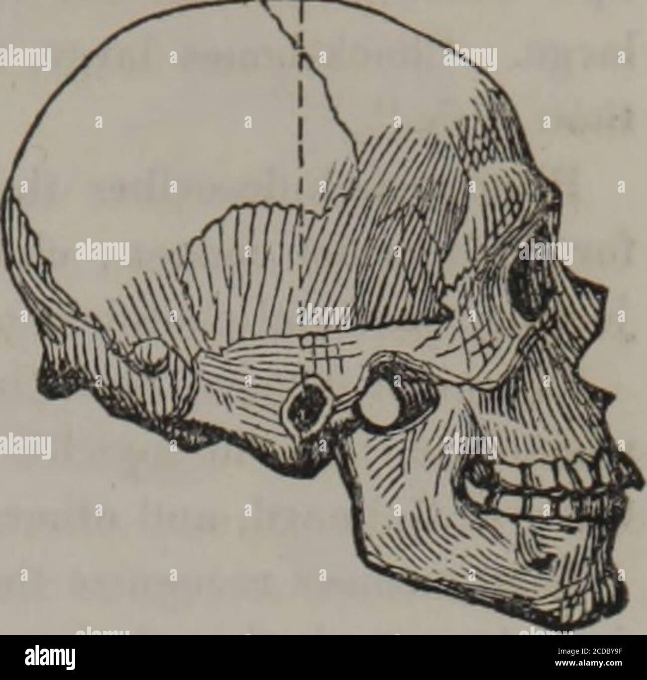 . Types d'humanité : ou recherches ethnologiques, basées sur les monuments anciens, les peintures, les sculptures, et la crania des races et sur leur histoire naturelle, géographique, philologique, et biblique. C. — Tasmanie. D.—Tasm an ian. Papuas, de Nouvelle-Guinée. La Nouvelle-Guinée est la plus grande de toutes ces îles après la Nouvelle-Hollande. De nombreux navigateurs, orteil vieux ainsi que les vivants, ont décrit ce peuple à diverses localités sur la côte ANATOMIE COMPARATIVE DES RACES, 435 Fig. 287.507. Nouvel homme de Guinée. FLQ. 288.508 les tribus semblent partout être sensiblement la même: Peau plus ou moins noire, featuu Banque D'Images