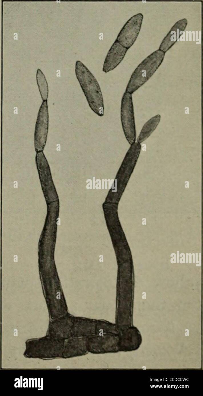 . Maladies fungeuses des plantes, avec des chapitres sur la physiologie, les méthodes de culture et la technique . Figure 133. Pêche SCAB sur le fruit charnu ce champignon est responsable de la très connue pêche scob, adisease commune dans tout le pays sur les pêches, et aussi onabricots. Il forme, en règle générale, des taches de sucette, circulaires, d'une certaine quantité, confinées à une portion du fruit et à d'autres moments dispersés sur la saine surface. Il est si commun sur la qualité plus pauvre du marché des fruits que dur-ing une saison ordinaire pratiquement hors de la deuxième ou troisième qualité des fruits, es-pecially que avec la pâte blanche, est fre Banque D'Images