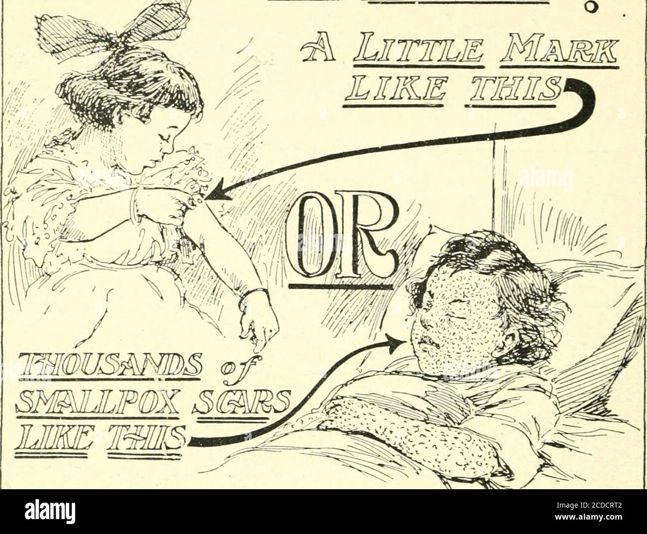 Variole Apres Banque D Image Et Photos Alamy