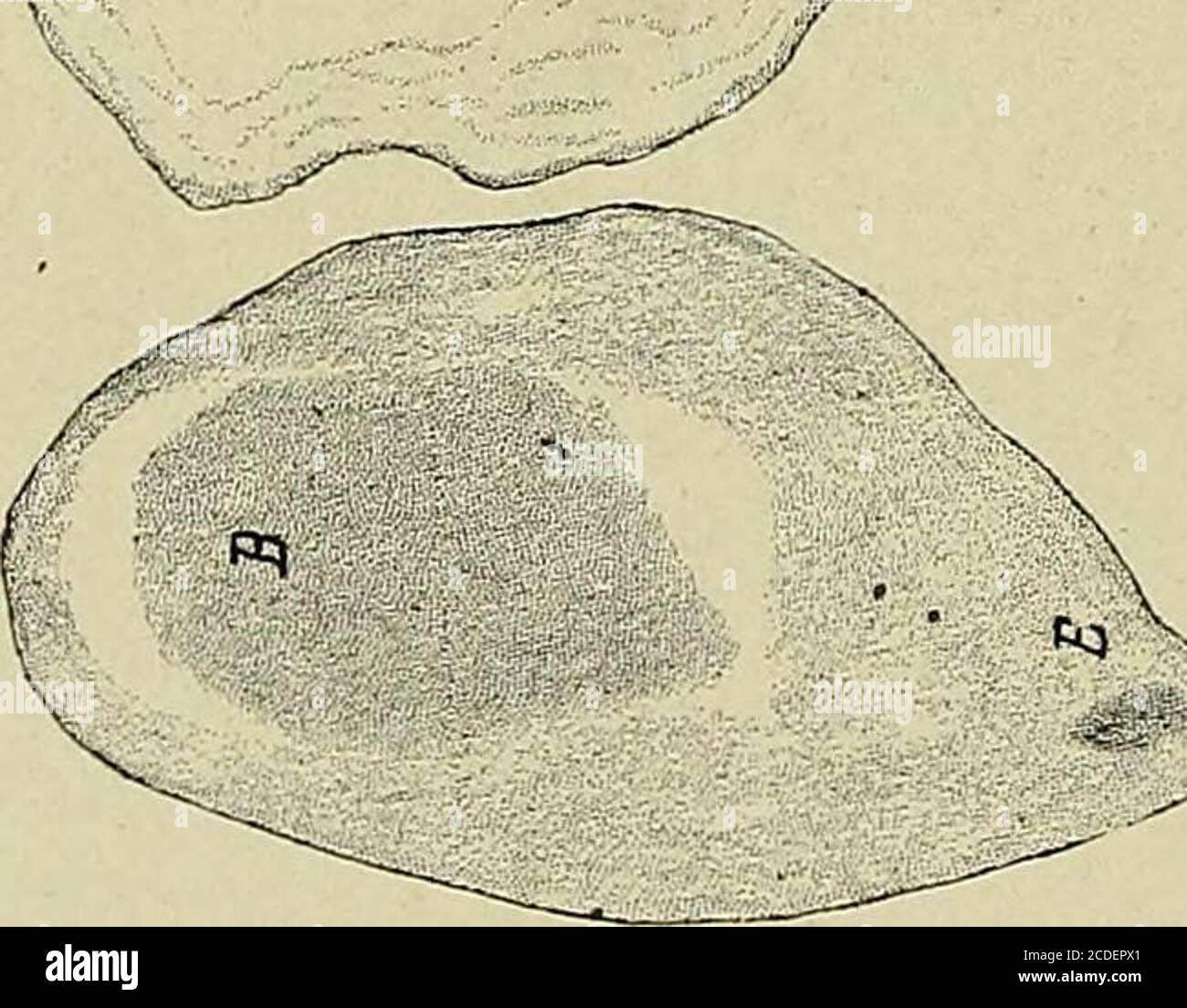 Une Etude Des Causes Sous Jacentes A L Origine Des Monstres Humains Troisieme Contribution A L Etude De La Pathologie Des Embryons Humains Figure 252a Photographie D Embryon Avec Amnion D Un Cote Et Chorion