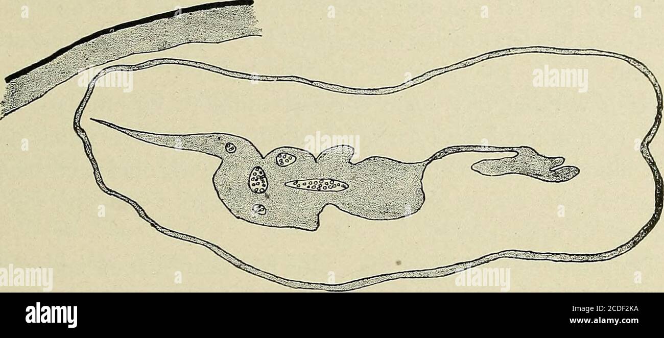 . Une étude des causes sous-jacentes à l'origine des monstres humains : troisième contribution à l'étude de la pathologie des embryons humains . Figure 130a.—Ovum avec vésicule extrudée. Taille naturelle. Contient une quantité considérable de magma re-ticule. À l'intérieur il y avait un long pédicule, mesurant 7x2mm. Il y avait aussi un espace dans le magma assez grand pour tenir la vésicule qui s'était échappée. L'ovule et le vesiclewere sont tous deux coupés en sections en série. Les sections en série de l'ovule montrent que l'amnion est toujours non cassé, comme le montrent les figures b, c, d. Ses plus grandes meas- N° i.] ORIGINE DES MONSTRES HUMAINS. 193 Banque D'Images