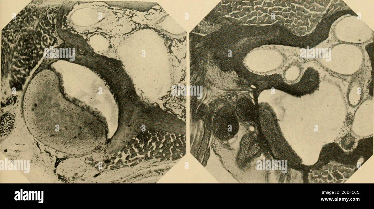 . Journal de morphologie . Figure 40.—Salamalaiidra adulte. Figure 41.—Salamandra adulte.. Figure 42.—Salamalaiidra adulte. Figure 43.—Triton adulte. Le Jouknal de MoKPHOLOGr.—vol XX, n° 4. Plaque VI Figure 44. La même chose. Section plus loin caudad, montrant l'opercule, M.opercularis et recessus perilymphaticus. Figure 45. Gyrinophilus porphyriticus, adulte. Section à travers la céphalicène du fenestra vestibuli et l'extrémité distale du stilus columellse montrant son articulation. Notez la relation entre les vaisseaux sanguins et le nerf facial. Figure 46. La même chose. Section à travers la base du stilus, quelques sectionsfarth Banque D'Images
