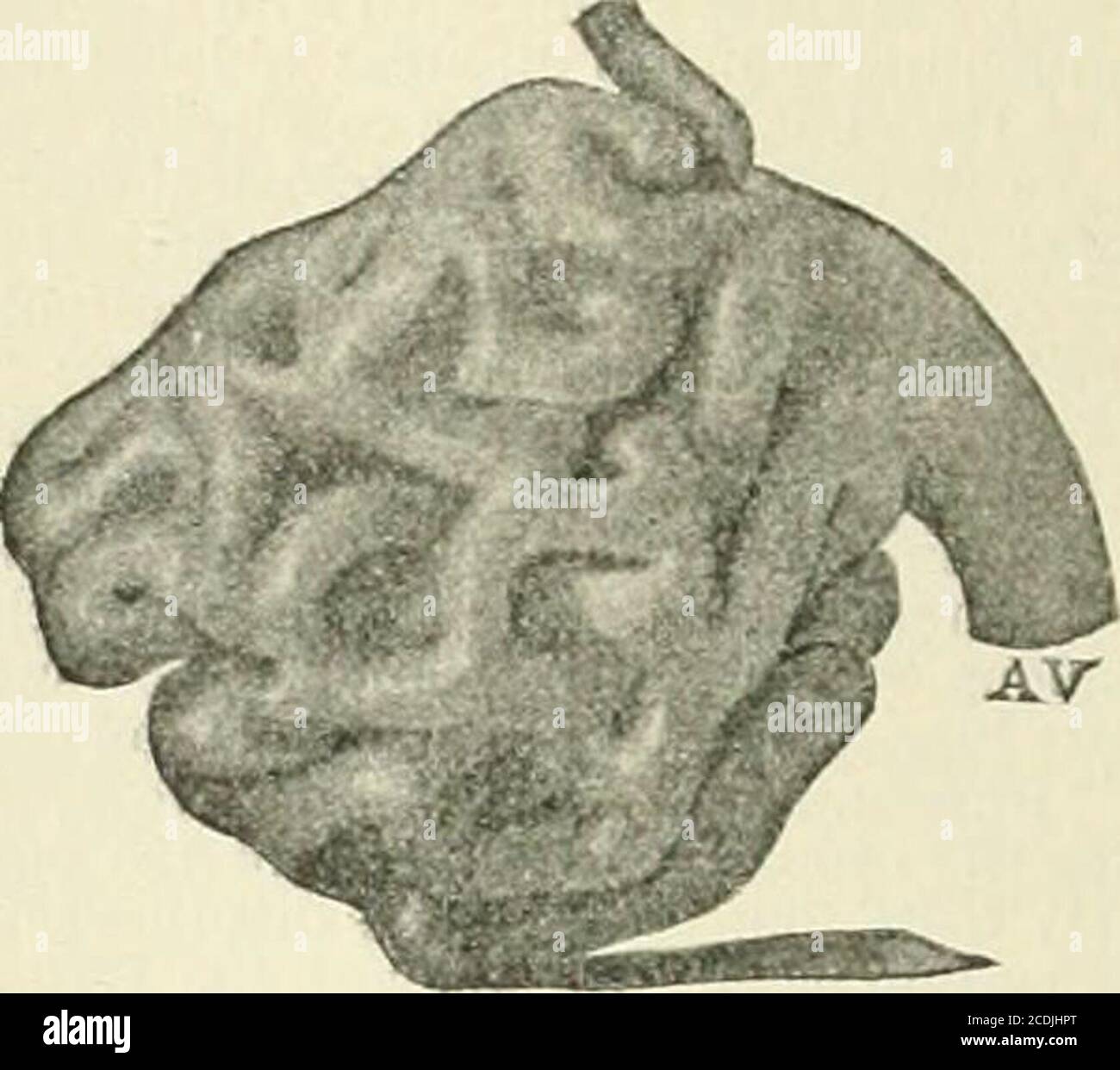 . Un manuel de référence des sciences médicales englobant toute la gamme de la médecine scientifique et pratique et de la science parascientifique . y a été glissé pour se composer de tissu conjonctif et de réticulum blancs fibreux. Mall et Rllhledécrivant les paniers de fibrilles réticulaires comme étant en arrière-plan des tubules et formant les membranes du sous-sol.l)isse et von Elmer, cependant, référer l'ap]iear fibrillaire aux méthodes de préparation, aud JIall, dans son dernier travail de 312 sur ces méinbranes, démontre clairement avec l'anthe ? panier de fibrilles du tissu conjonctif précédemment décrit, une membrane homogène qui était la plus haute Banque D'Images