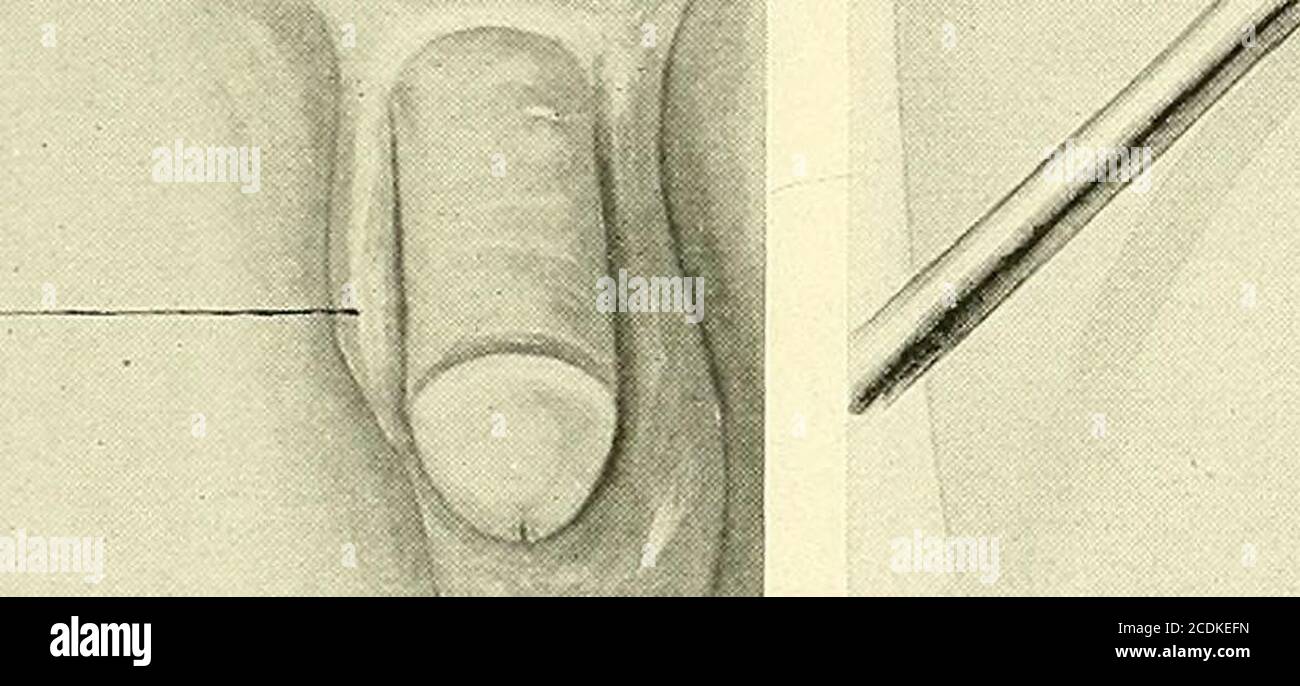 Physical Deformity Banque D Image Et Photos Alamy