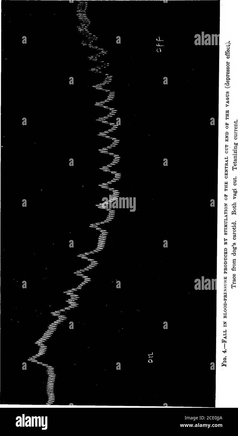 . L'étude clinique de la pression artérielle : un guide de l'utilisation du sphygmomanomètre dans la pratique médicale, chirurgicale, et obstétricale, avec un résumé des faits expérimentaux et cliniques relatifs à la pression artérielle dans la santé et dans la maladie . Ood passant par leurs vaisseaux. Ceci, bien sûr, est fourni par une dilatation des artères à travers la glande. Une telle dilatation générale des petites artères dans toute zone vasculaire provoque une chute de la pression latérale dans l'artère principale qui l'alimente. Si la zone est suffisamment étendue, et n'est pas compensée par vaso-constriction dans d'autres vascularistr Banque D'Images