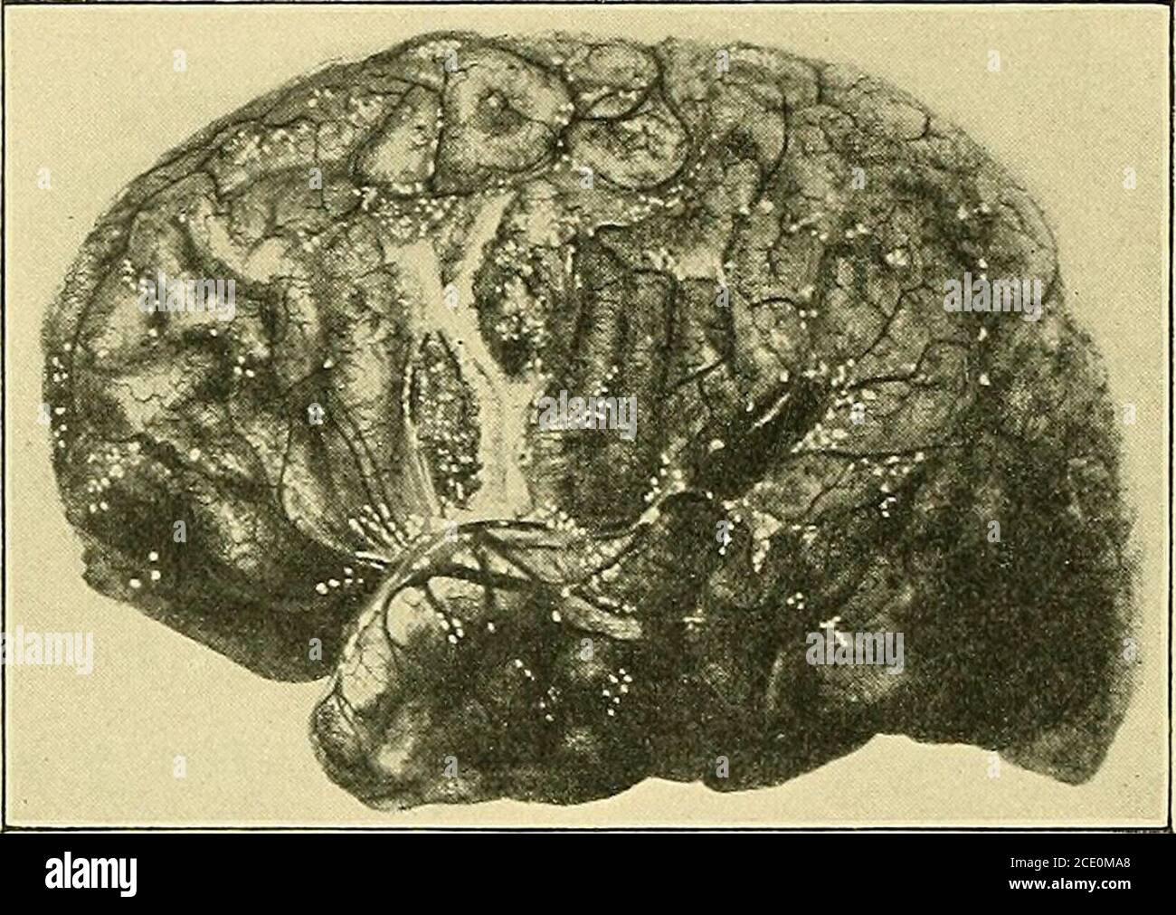 Quelques points dans la chirurgie du cerveau et de ses membranes ...