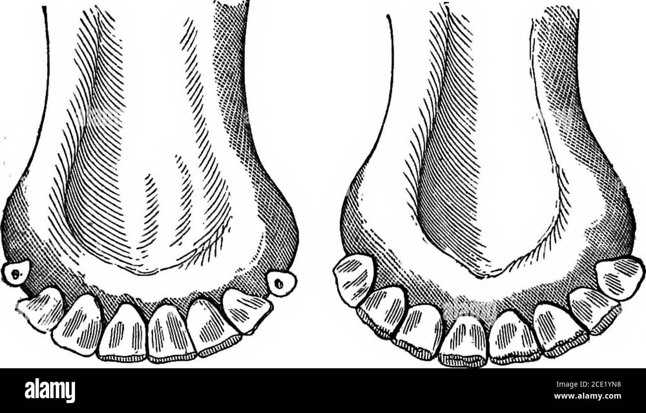 . Vaches laitières et élevage laitier; comprenant les races, l'élevage et la gestion, dans la santé et la maladie, des stocks laitiers et autres; la sélection des vaches laitières, avec une explication complète de la méthode de Guenon; La culture des plantes fourragères, et la production de lait, de beurre et de fromage ... avec un traité sur l'élevage laitier de Hollande; auquel s'ajoute le système de gestion laitière d'Horsfall . Figure 23. Dix-huit mois. Grande. 24. Deux ans plus tard a grandi à la surface, avec la troisième paire juste percep-ible. Ces changements exigent du temps ; et à deux ans, la mâchoire apparaîtra habituellement comme dans la Fig. 24, w Banque D'Images