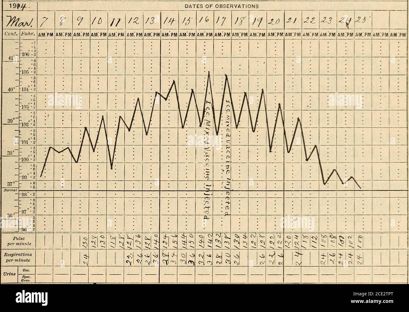 . Maladies de l'enfance et de l'enfance . Figure 145.—Tableau des températures, cas I. vaccins contre la typhoïde.—l'injection préventive de vaccin contre la fièvre typhoïde est préconisée par l'Armée des États-Unis. Il existe des preuves sutficientes pour démontrer que la fièvre typhoïde peut être évitée par une série d'injections prophylactiques.quand, par conséquent, les enfants sont à il envoyé dans un district où la sanitaire ^ Voir l'article complet sur la vulvovaginitis dans la fièvre de Scarlet. VACCINS BACTÉRIENS. 453 les conditions ne sont pas perfcict^ il est advisafjle à i^ivo eux un propliylactio injection-tion du vaccin typhoïde^ plutôt que de courir le risque de contracter Banque D'Images