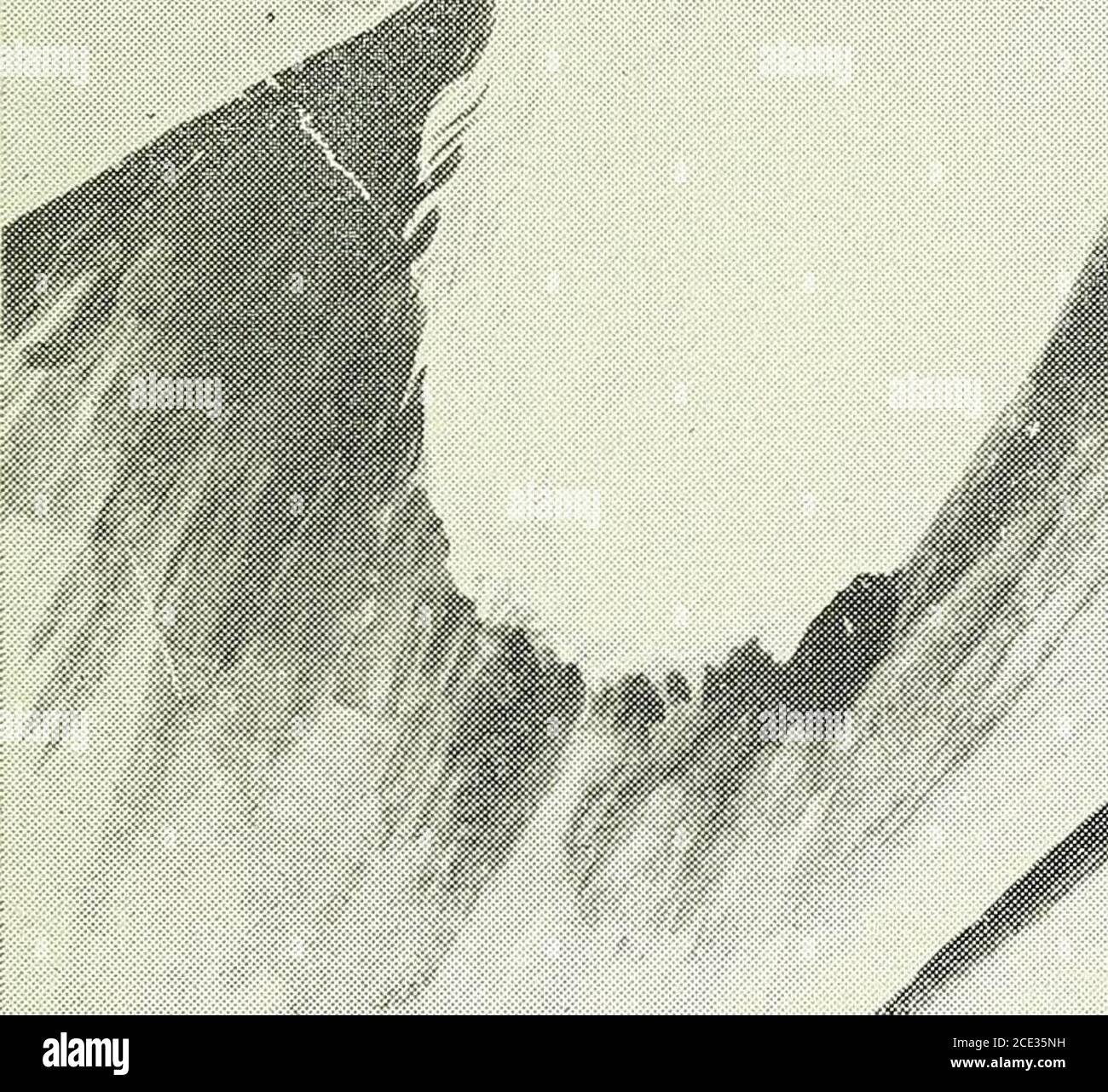 . Cent ans de médecine et de chirurgie au Missouri; revue historique et biographique des carrières des médecins et chirurgiens de l'état du Missouri, et croquis de certaines de ses institutions médicales remarquables. JOHN S. MOORE. MÉDECINE ET CHIRURGIE. 37 Sity of Pennsylvania and the pupilles of the Blockley Hospital, Philadelphia, J'ai eu le plaisir d'écouter de temps en temps le deuxième cours de lecturesin de cette institution pionnière. C'était le jour de petits débuts dans la voie de l'enseignement médical à Saint Louis; mais comme les grands chênes de littleacorns se développent, ainsi ce collège de parents, après l'uedn Banque D'Images