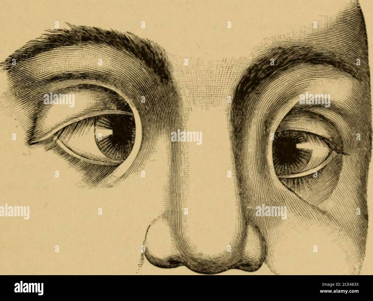 Anomalies Congenitales Banque D Image Et Photos Alamy Anomalies Congenitales Banque D Image Et Photos Alamy