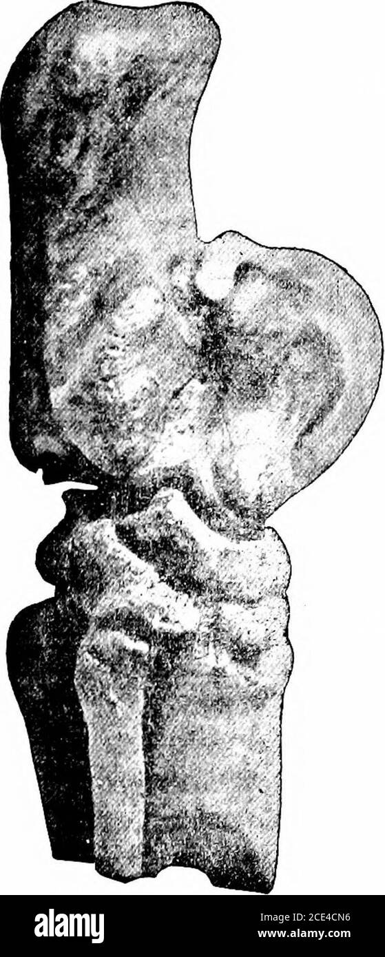 . Les principes et la pratique de la chirurgie vétérinaire . sur les autres, je ne pense pas que la parfaite re-storation peut être effectuée. Si, toutefois, le traitement habituel de la spavine, à savoir, cloques, firin^r,chaussure à talon élevé, et l'allongement de l'étreest inefficace, nous pouvons effectuer l'une ou l'autre des opérations de suivi : — ténotomie cunéenne, donnant un soulagement direct de la pression sur le tendon. Les neurétomies tibiales antérieures et postérieures (ope-ration Bossis), qui coupent la sensa-tion du jarret comme indiqué dans les plaques. J'ai trouvé avec frasjuence l'insertion d'une truelle sous la peau, et immédiatement sur la sp Banque D'Images