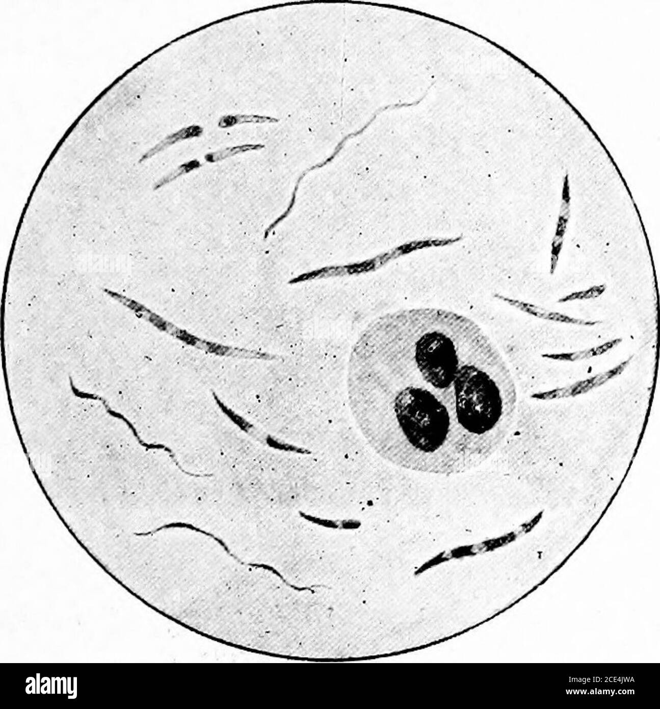 . Microörganismes pathogènes; un manuel pratique pour les étudiants, les médecins, et les agents de santé . t part dans la maladie et meningsouvent à des complications graves (septicémie et broncho-pneumonie). Les invasions indiquent que lorsque d'autres bactéries pathogènes sont associésavec les bacilles diphtérique, elles s'aident mutuellement dans les attaques contre la muqueuse, le streptocoque étant par-ticulièrement actif à cet égard, Souvent ouvrir la voie pour l'invasiondu bacille LofHer dans les tissus plus profonds ou fournir les con-ditions nécessaires pour le développement de sa toxine. Dans la plupart des cas mortels Banque D'Images