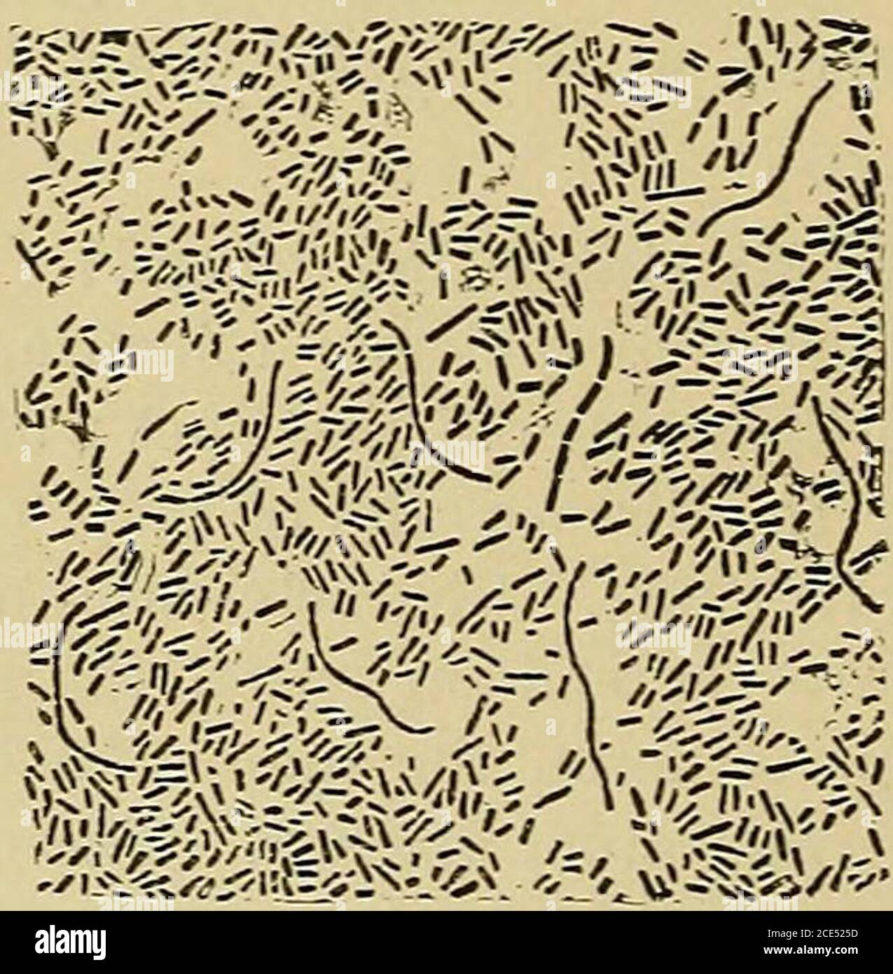 . Principes de base du diagnostic. Organisé sous forme de questions et réponses préparées spécialement pour les étudiants en médecine . Le diagnostic différencialdiagnostique des autres maladies mentionnées sera succinsvelydéveloppé. Fièvre typhoïde—fièvre entérale. Qu'est-ce que la fièvre typhoïde ? La fièvre typhoïde ou entérique est une maladie infectieuse aiguë, appartenant au groupe de fièvres essentielles et continues, dépendant du micro-organisme aspécique, et présentant des lésions constantes : inflammation, gonflement, ramollissement et ulcération des patchs de Peyers, agrandissement et ramollissement des glandes mésentériques et faction de la sume des s. Banque D'Images