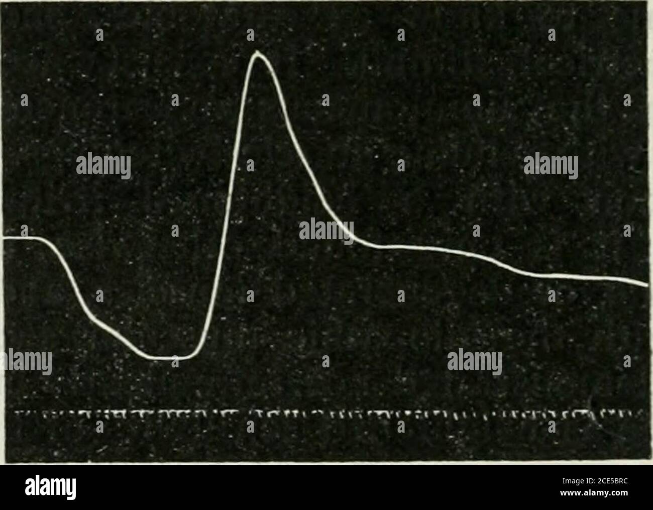 Démence praecox et paraphrénie . Figure 14.mouvement simple du doigt en  Catatonia (a). Figure 13. Mouvement normal des doigts. En dehors de la plus  petite excursion du mouvement, ananormale qui apparaît