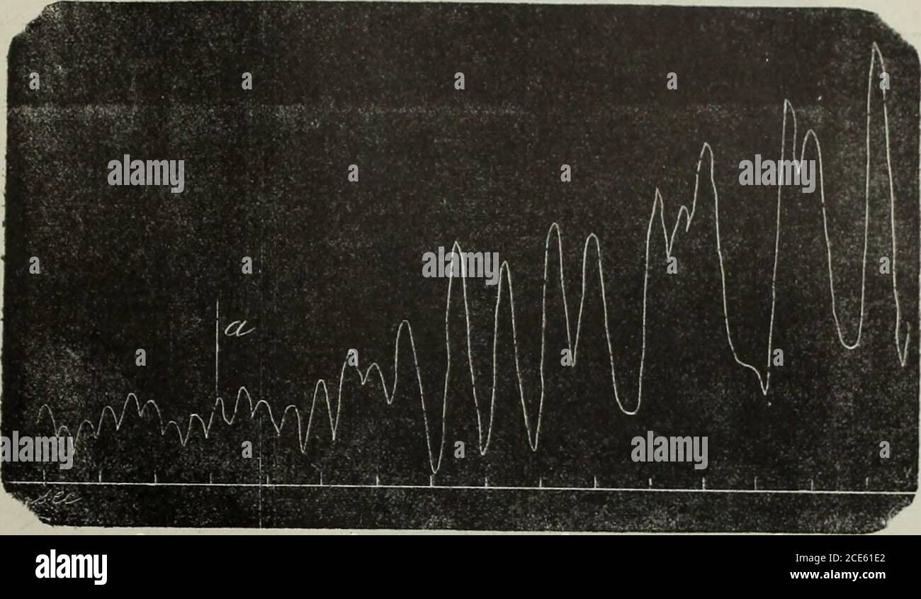 . Giornale di Scienze Naturali ed Economiche di Palermo . Grafica III—Cane curarizzato. Pressione della femorale. Dans une si inietta nella carotide primitiva destra 1 cm.c. di soluzione di acido prussico. STUDtl SUOLA. SEMSLBILITÀ DEL CUOAE E DE£ VASI SANGUIRNB 336 Nella spiegazione di questi fatti il criterio del tempo ci sorregge come nelle altreesperienze, poiché riesce impossibile concepire Come, con un ritardo, spesso appena apprez-zabile, la sostanza ececcitorante, recichira, recichira pusasi puscene, pura pura pura pura puscene, pura pura pura pura pura pura pura eccitaregli elementi dello spinale e produrre il rallentamento del cuore. G Banque D'Images