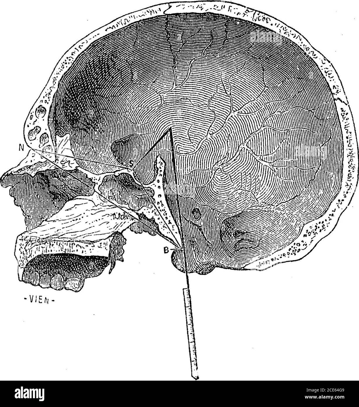 . Anthropologie . angle étafacial de Serres, que le ptérygoidprocessus forme avec la base du crâne. Il nous semble de varyavec le pronatisme, mais pas beaucoup. (b) le corono-facialiangle de Gratiolet, formé par la rencontre du plan passant par la suture coronale des deux côtés et la ligne faciale de Camper, (c) l'angle basal naso, décrit à la page 255. (d) le * sur les grues Basques de Zaraus, dans le Mem. DAnthrop./ par PauBroca, vol. ii. P. 28. u 2 292 ANGLE SPHENOIDAL. [Angle sphénoïdal Bonjour. de Welcker chap. (e) l'angle de Barclay. (/) angle Thecranio-facial de Huxley, qui d Banque D'Images
