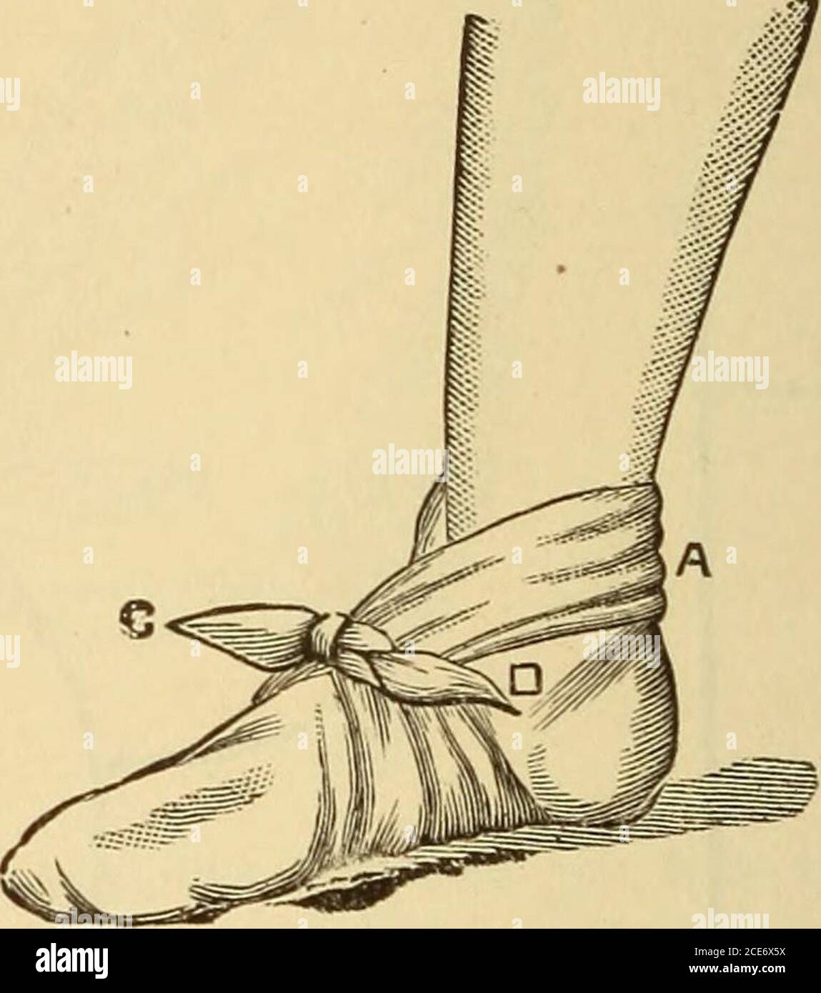 . M. Evans's Comment bien garder; . Figure 367.—bande de tkiangle sur le pied. Le pied doit être placé sur le triangleavec la base A vers l'arrière, et a posé le behind la cheville, l'apex étant porté vers le haut du dorsum ou le haut du pied. Les extrémités basales C et D sont amenées vers l'avant, croisées, puis portées autour du pied, et attachées sur le dessus. Figure 366. — Figure de l'Eightbandage du pied Ankleand. Nombre itinéraire en entrée pris par bande- Banque D'Images