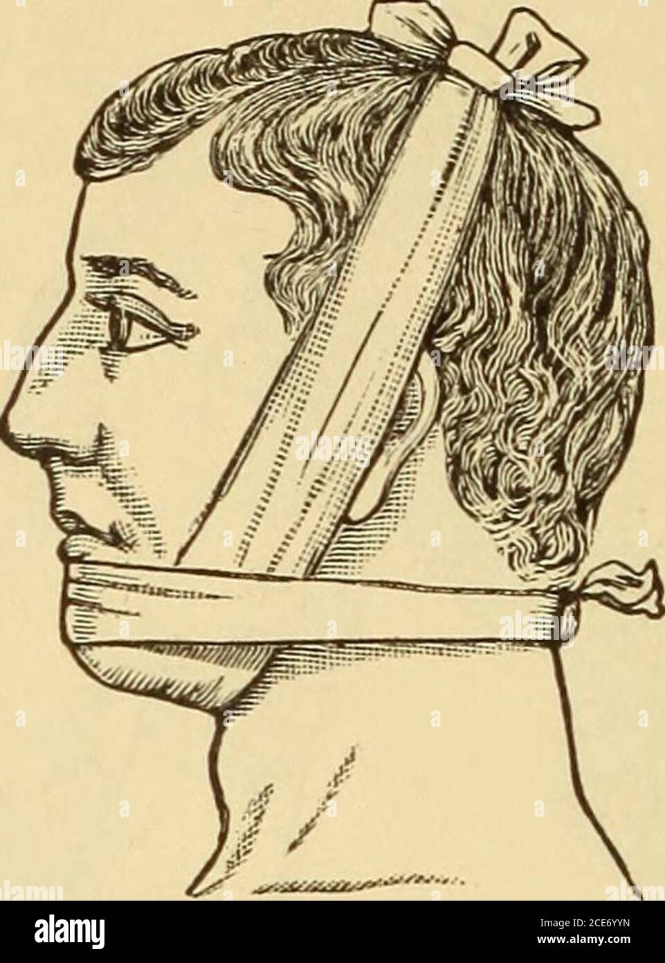 M Evans S Comment Bien Garder Figure 340 Bande Triangulaire Pour Tete La Base A Est Placee Vers Le Bas Au Dessus Du Front Et L Apex B Au Niveau De La Nuque Les