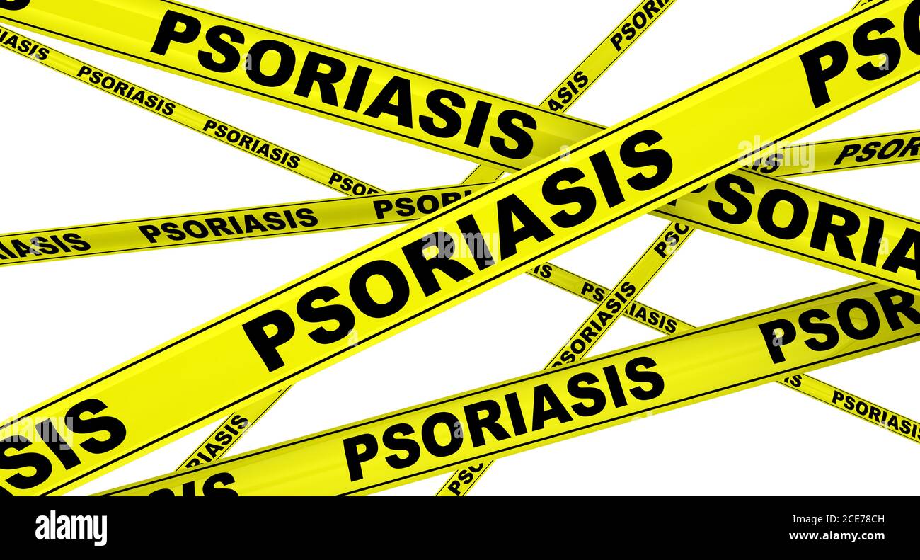 Rubans d'avertissement jaunes avec des mots noirs PSORIASIS (est une maladie auto-immune de longue durée caractérisée par des taches de peau anormale). Isolé Banque D'Images