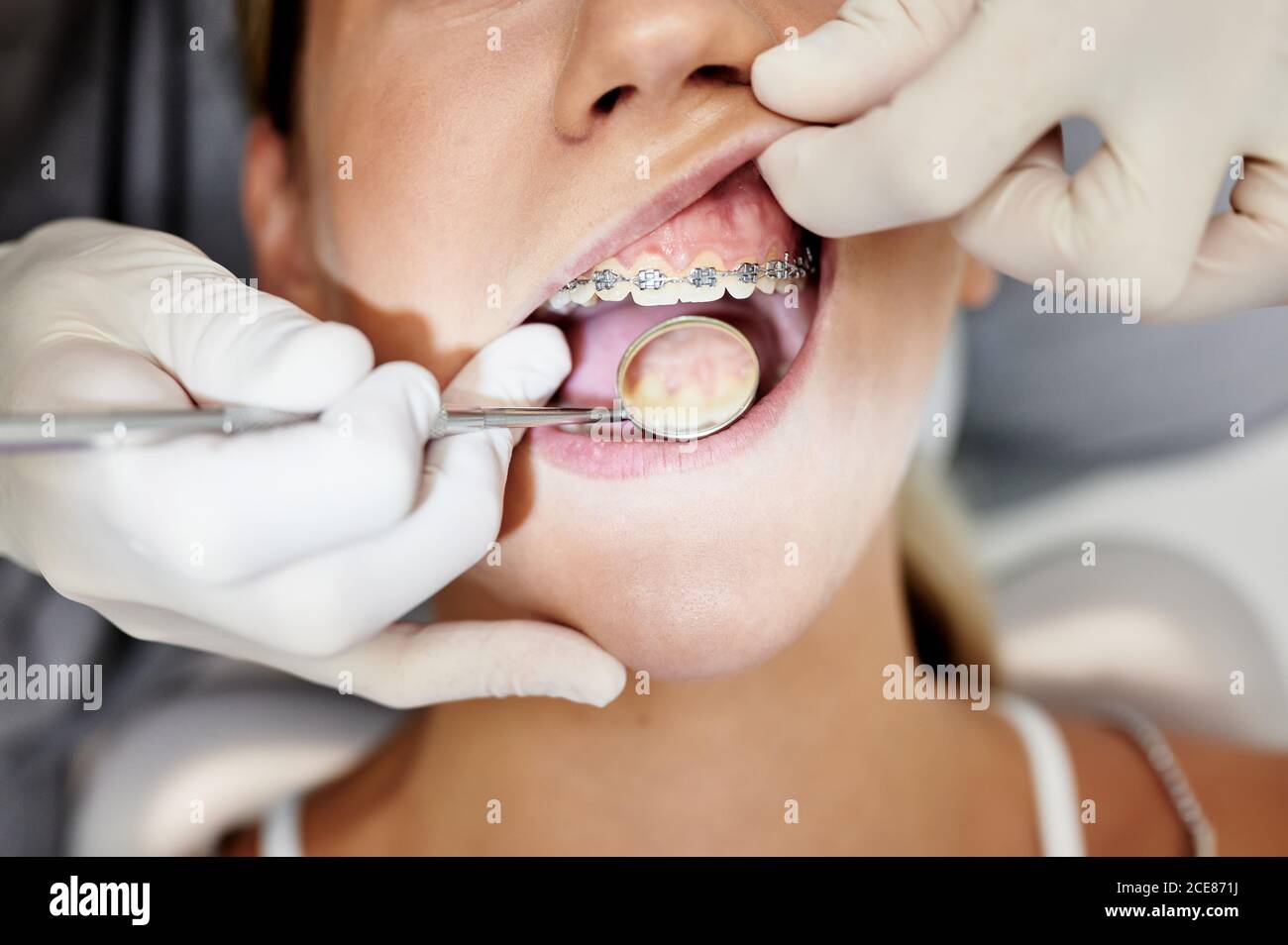 Du dessus de la récolte femelle dentiste non reconnaissable dans des gants utilisant le miroir pour vérifier les dents de la femme avec des bretelles pendant le travail dans la clinique contemporaine Banque D'Images