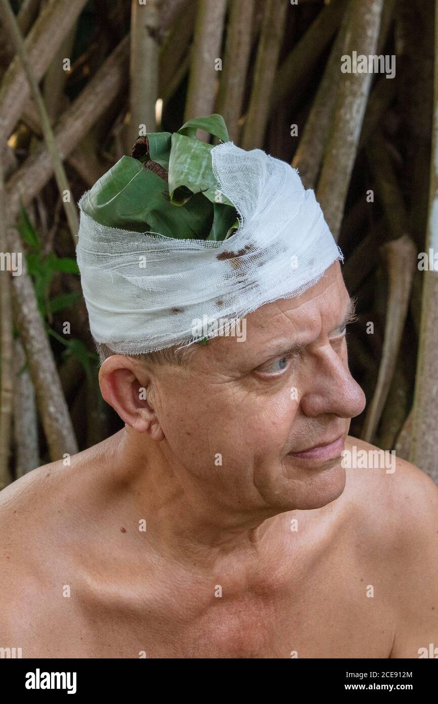 Sri Lanka, Waduwa, Life Ayurveda Resort. Traitement Panchakarma. SHIRO LEPA. Les poudres médicinales et les herbes sont faites dans une pâte et appliquées sur le cuir chevelu Banque D'Images