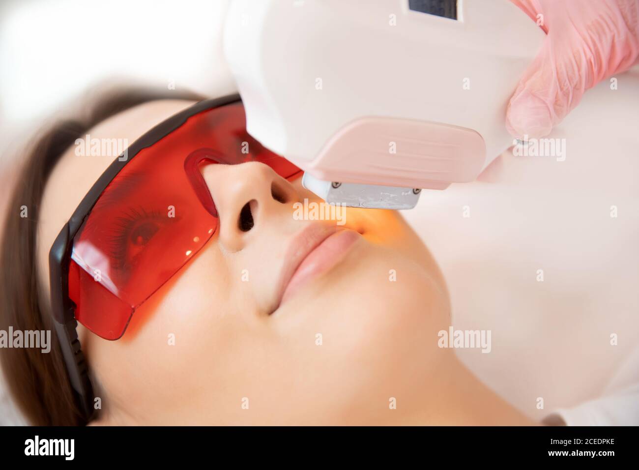 Épilation laser des poils indésirables sur la moustache de la jeune femme.  Concept de beauté et de santé Photo Stock - Alamy